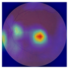 Biomedicines 12 02092 i010