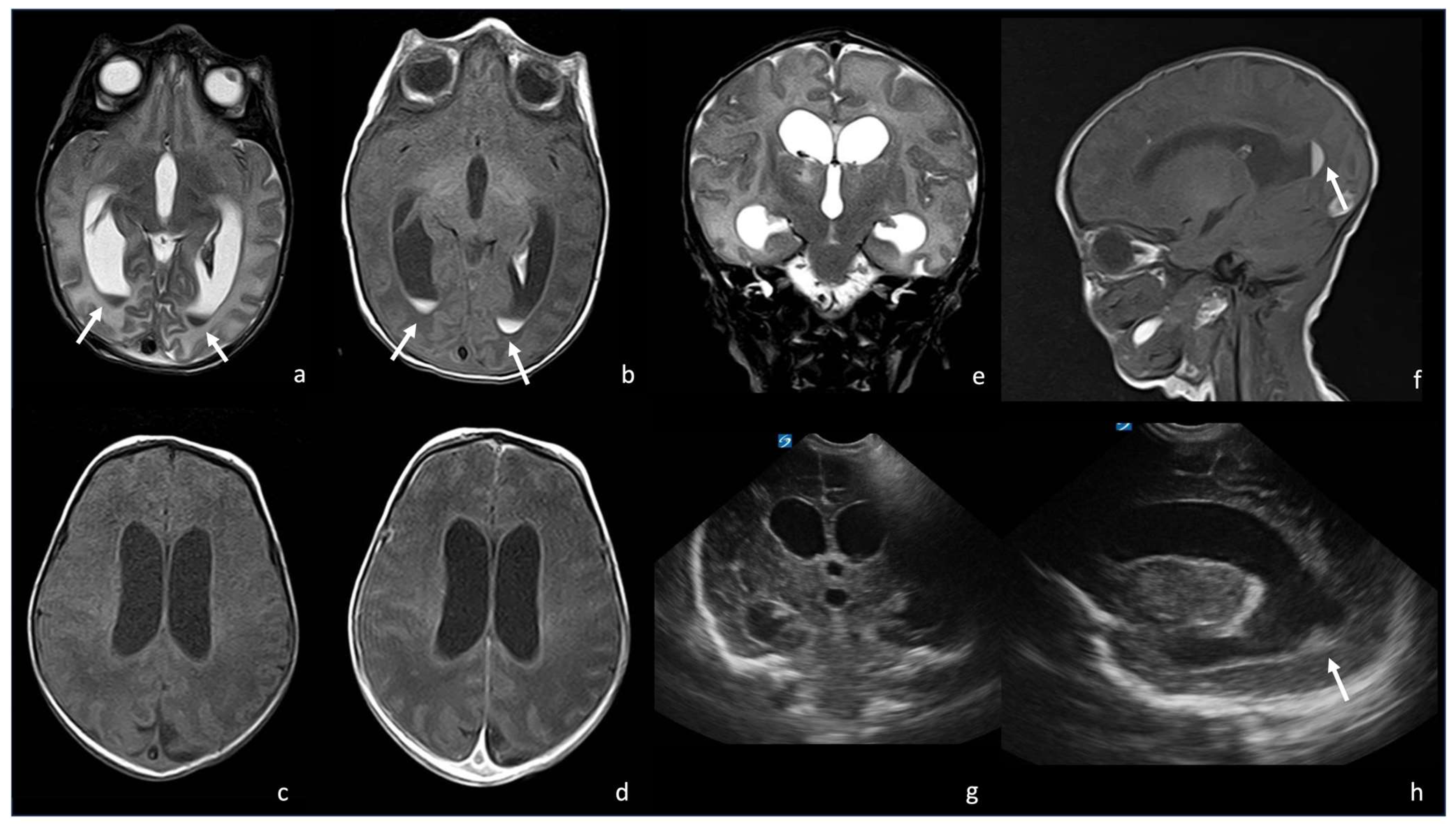 Biomedicines 12 02490 g003