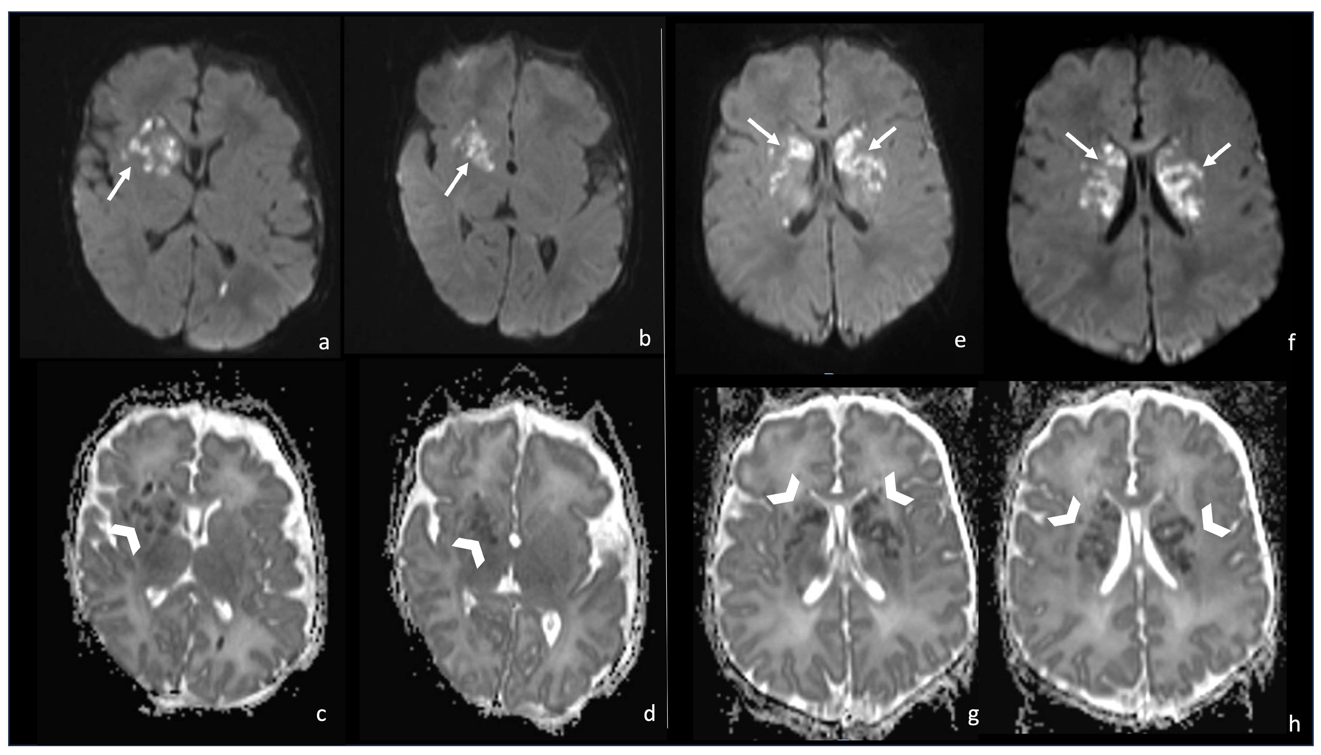 Biomedicines 12 02490 g009
