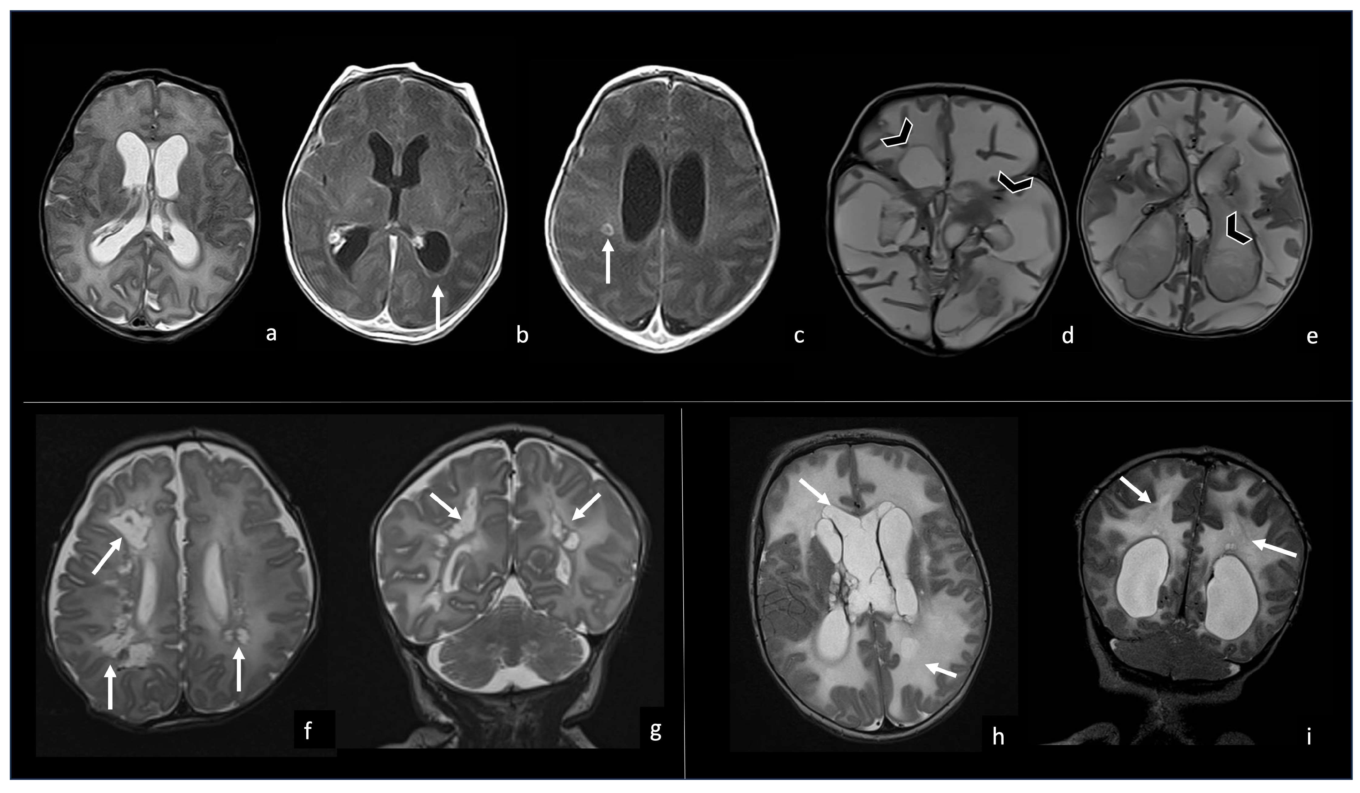 Biomedicines 12 02490 g010