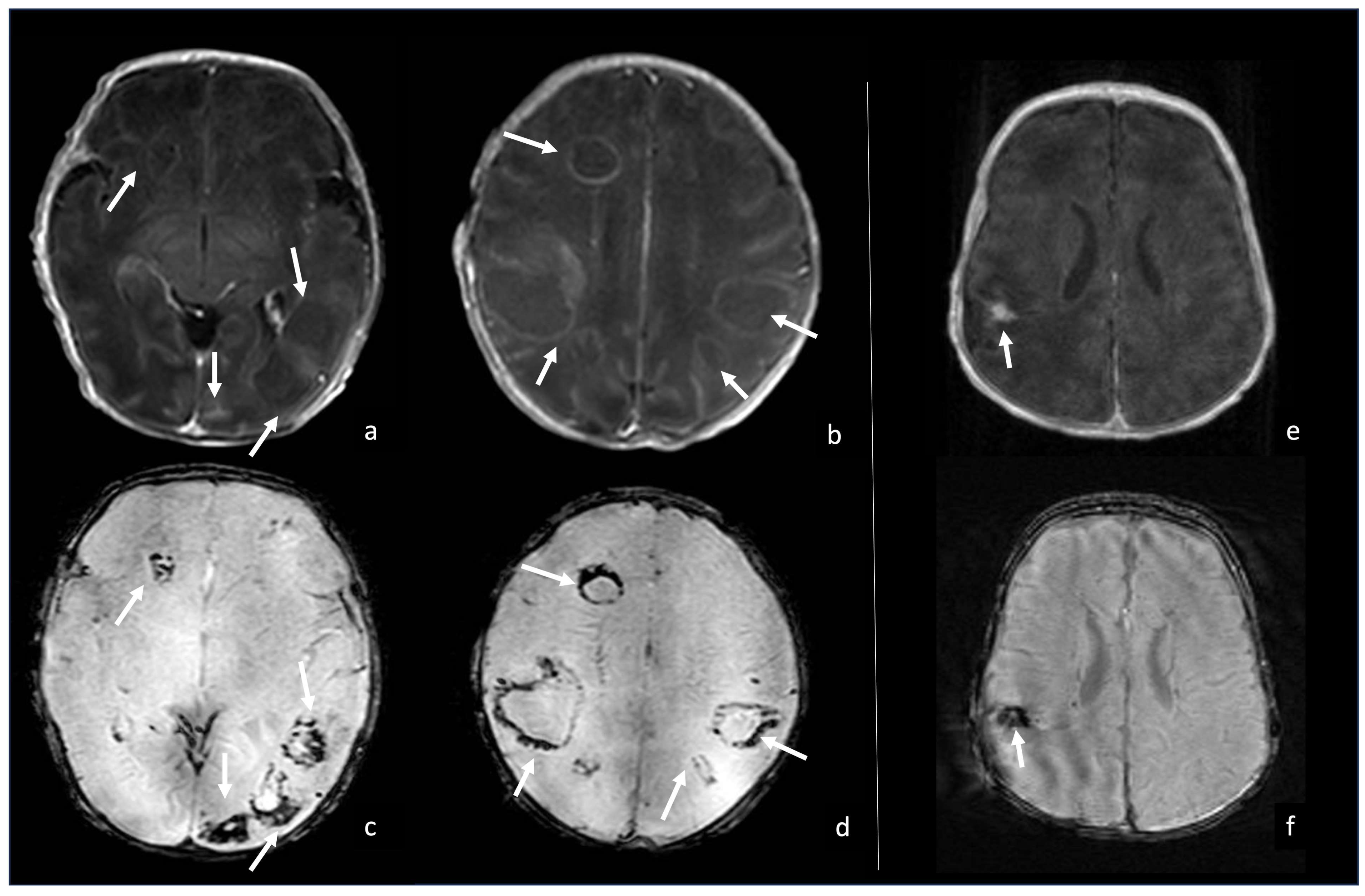 Biomedicines 12 02490 g011