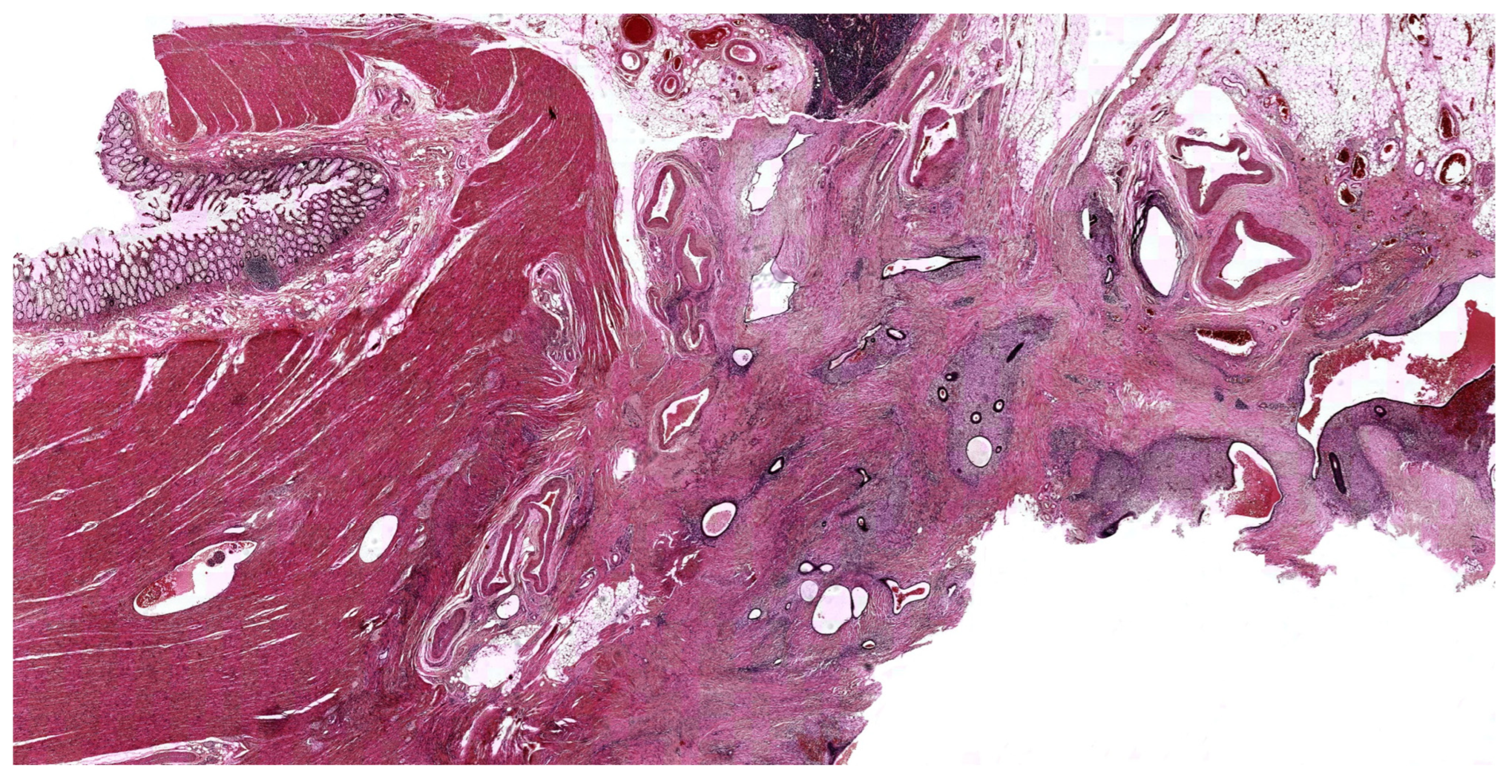 Biomedicines 12 02521 g004