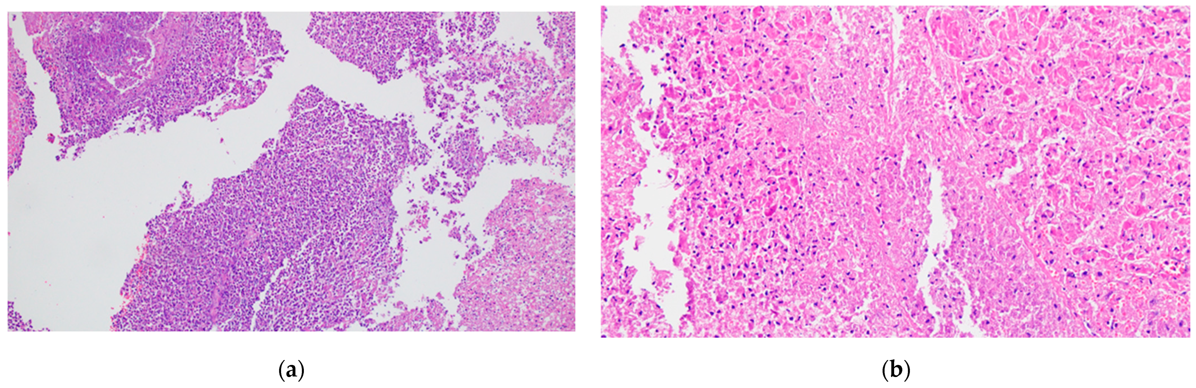 Biomedicines 12 02627 g011