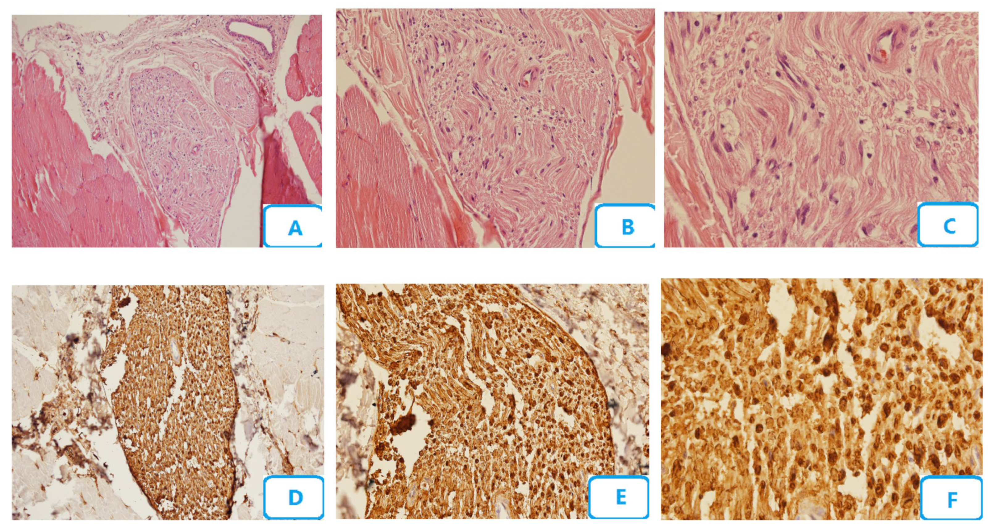 Biomedicines 13 00065 g003 Biomedicines 13 00065 g003
