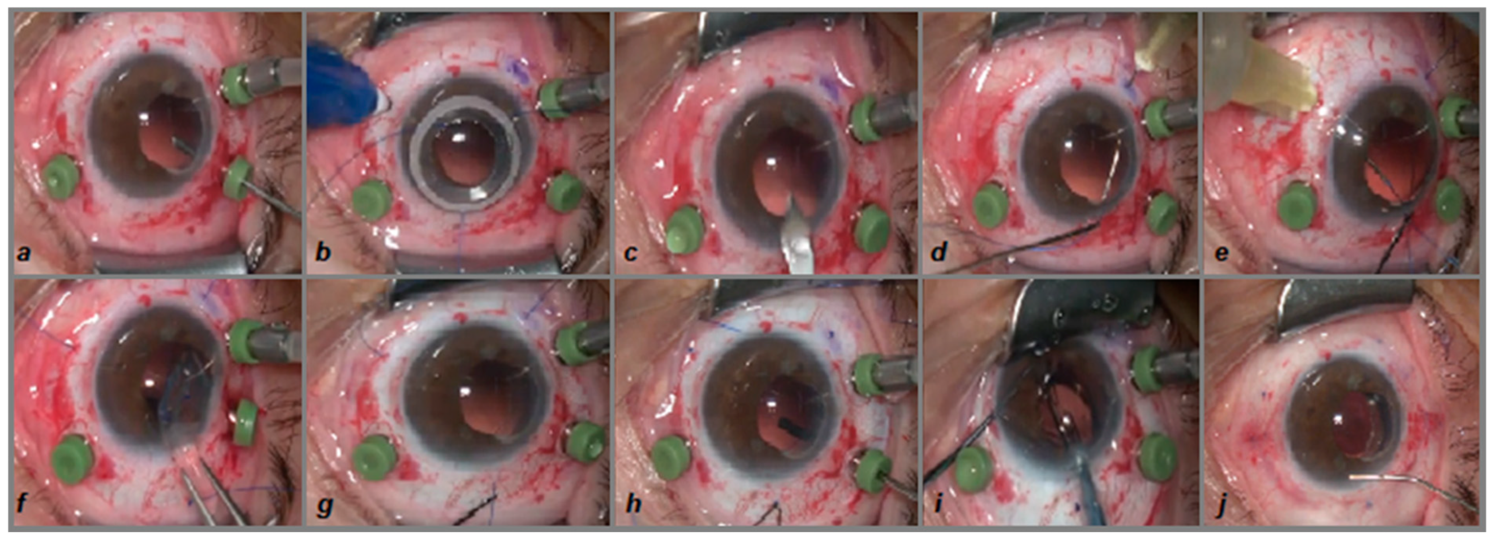Biomedicines 13 00162 g003