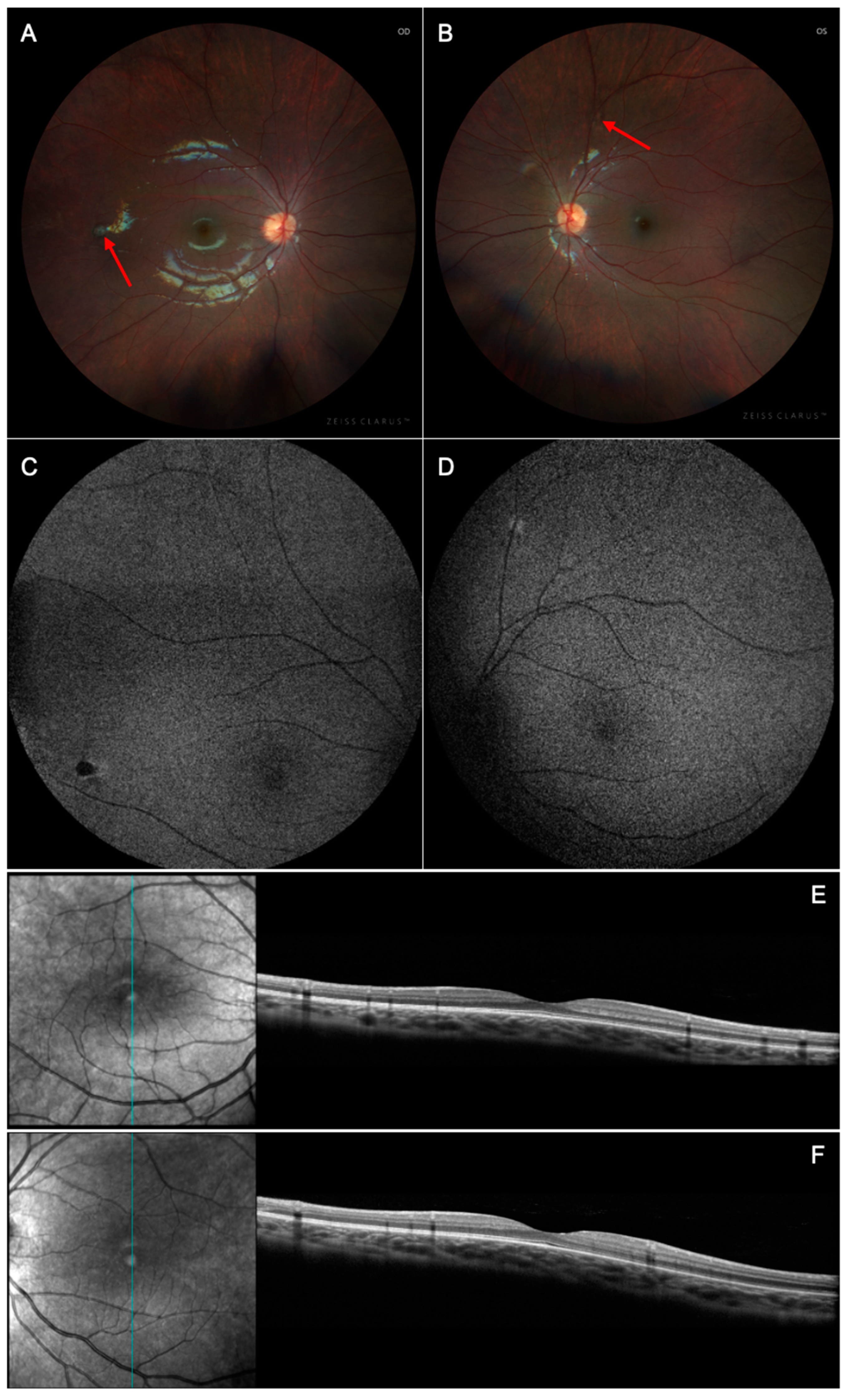 Biomedicines 13 00323 g004