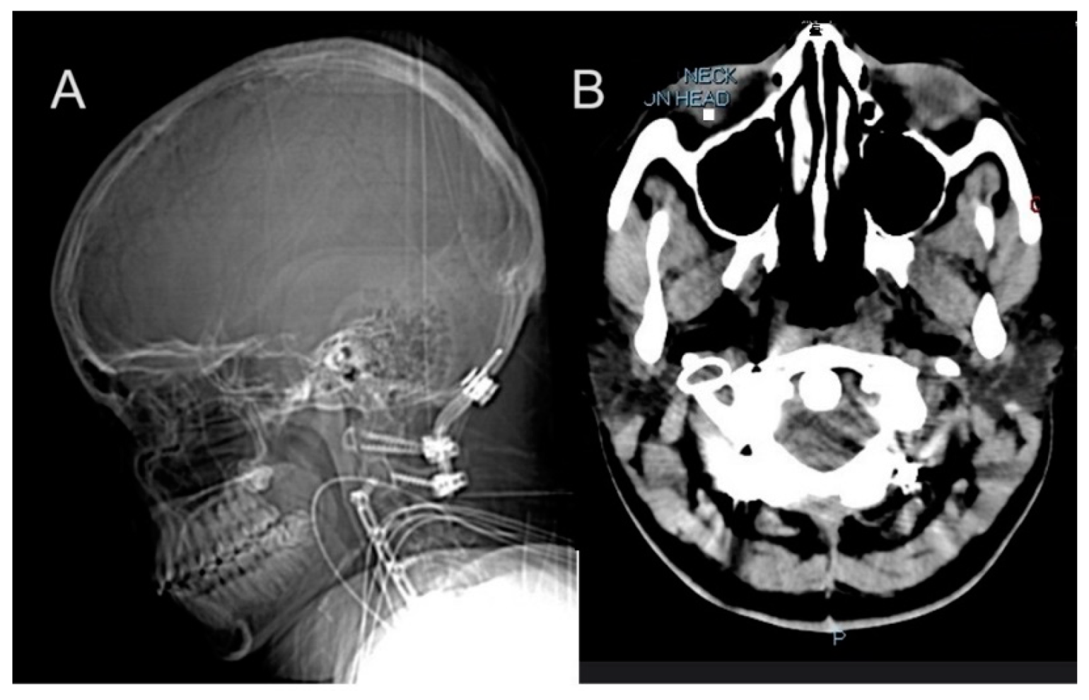 Biomedicines 13 00469 g002a