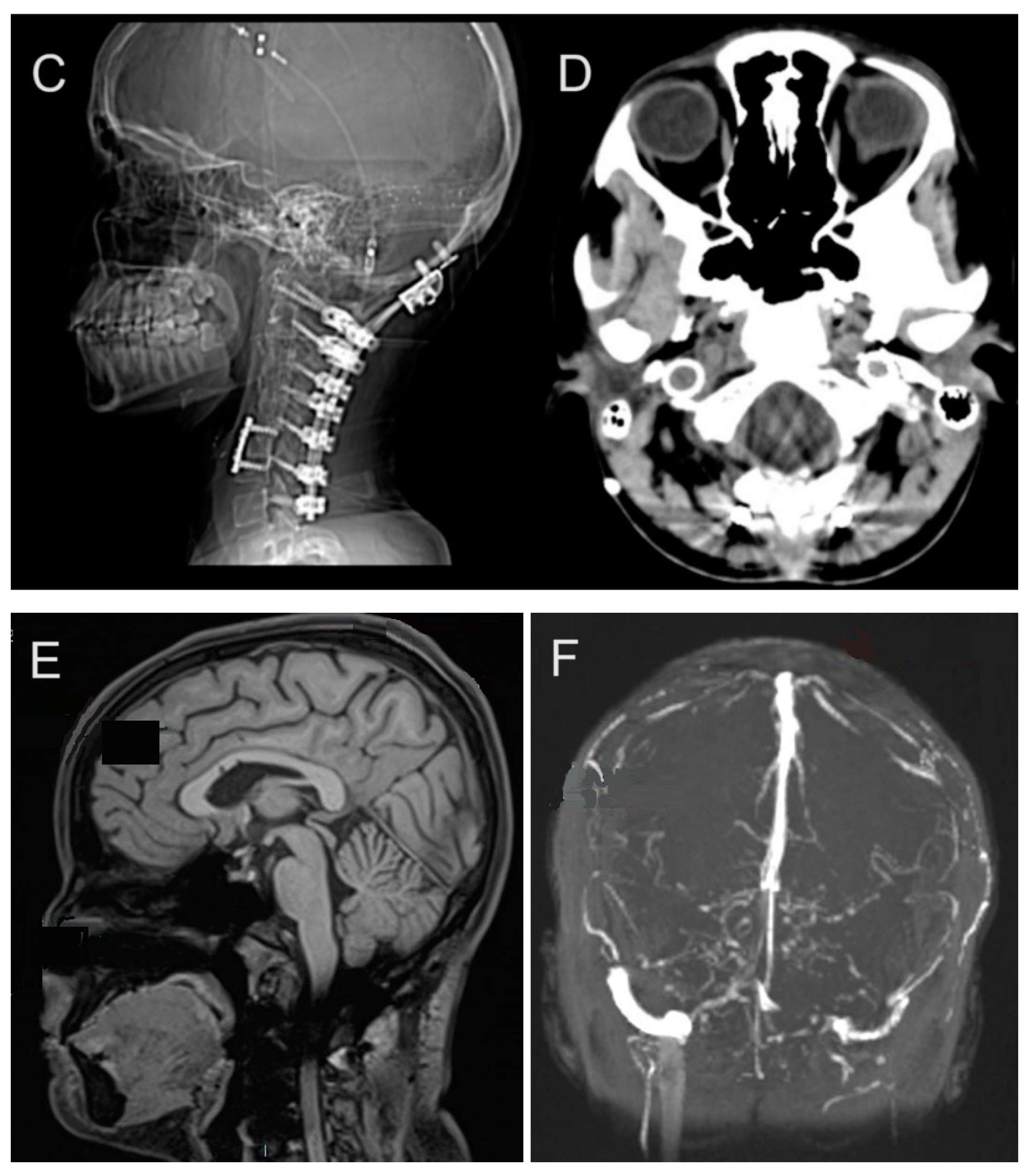 Biomedicines 13 00469 g002b