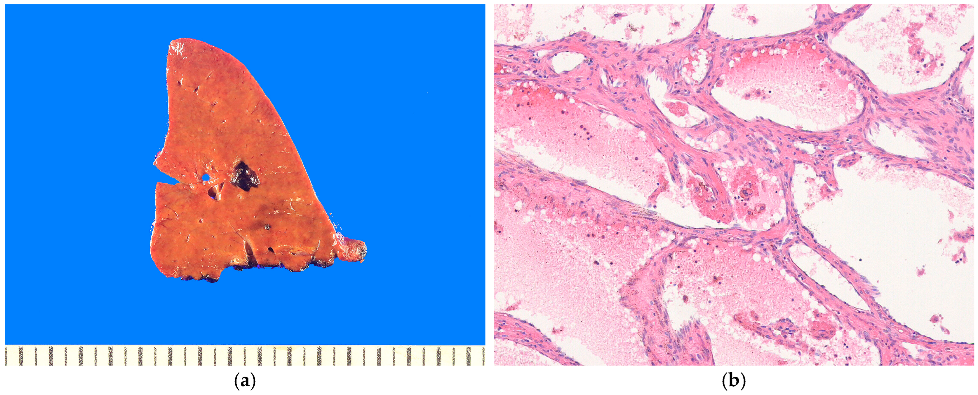 Biomedicines 13 00479 g002