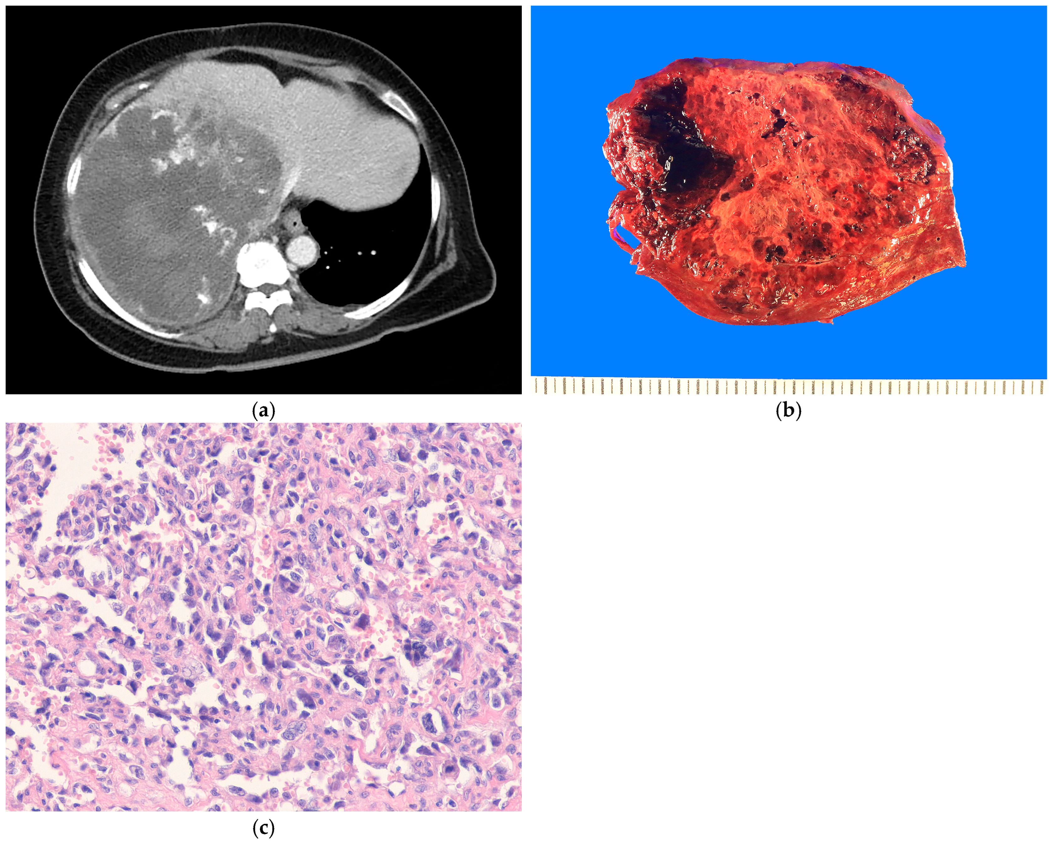 Biomedicines 13 00479 g004