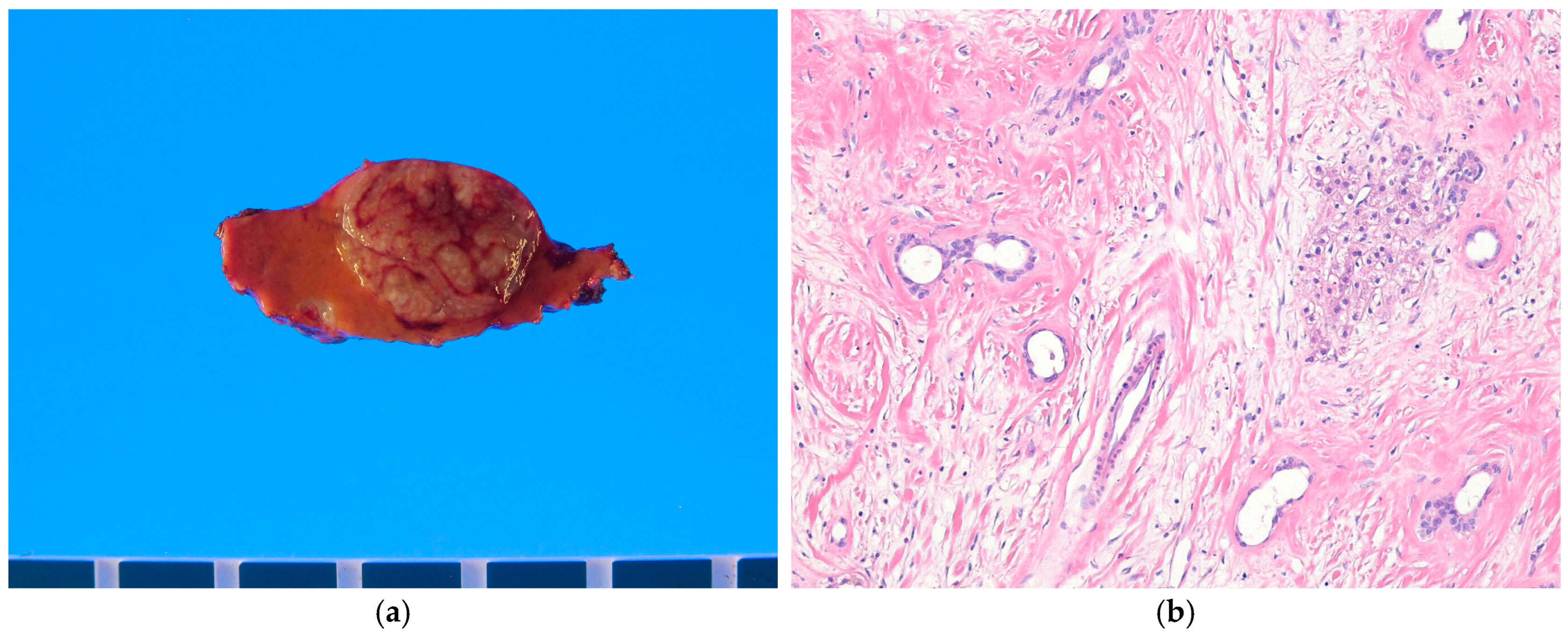 Biomedicines 13 00479 g006