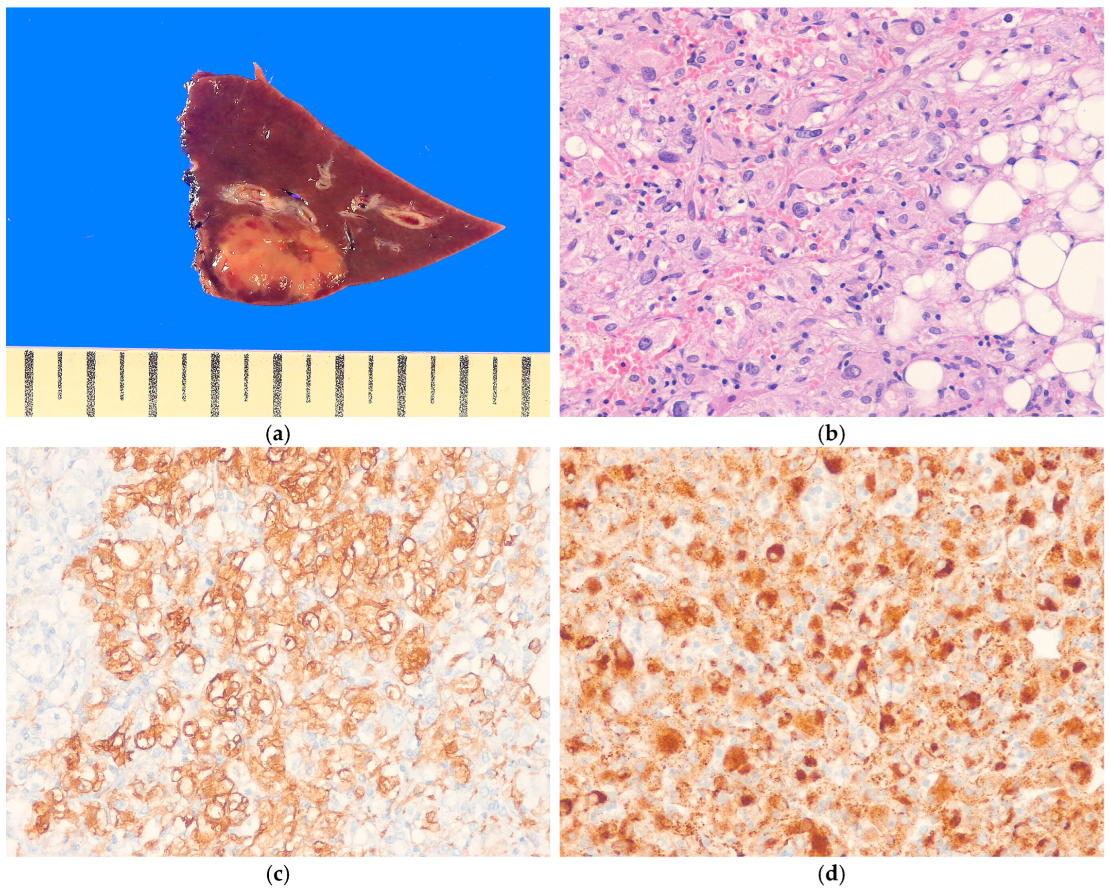 Biomedicines 13 00479 g007