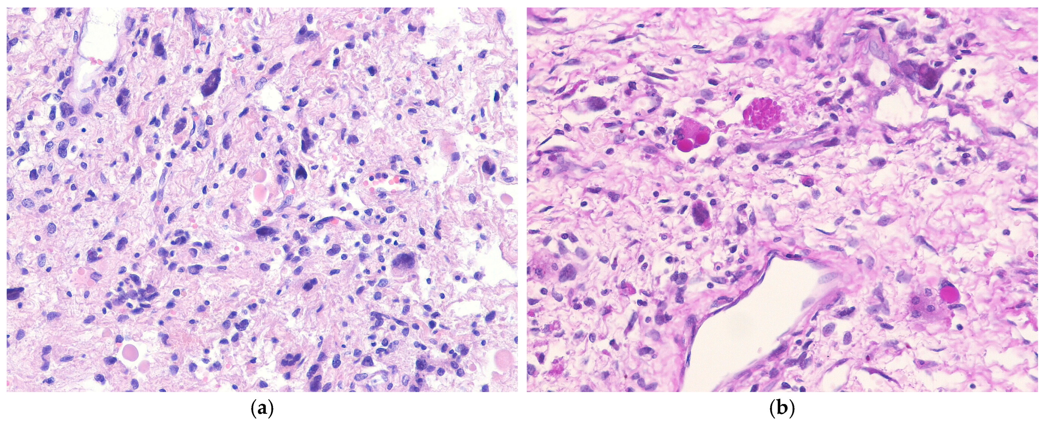 Biomedicines 13 00479 g009