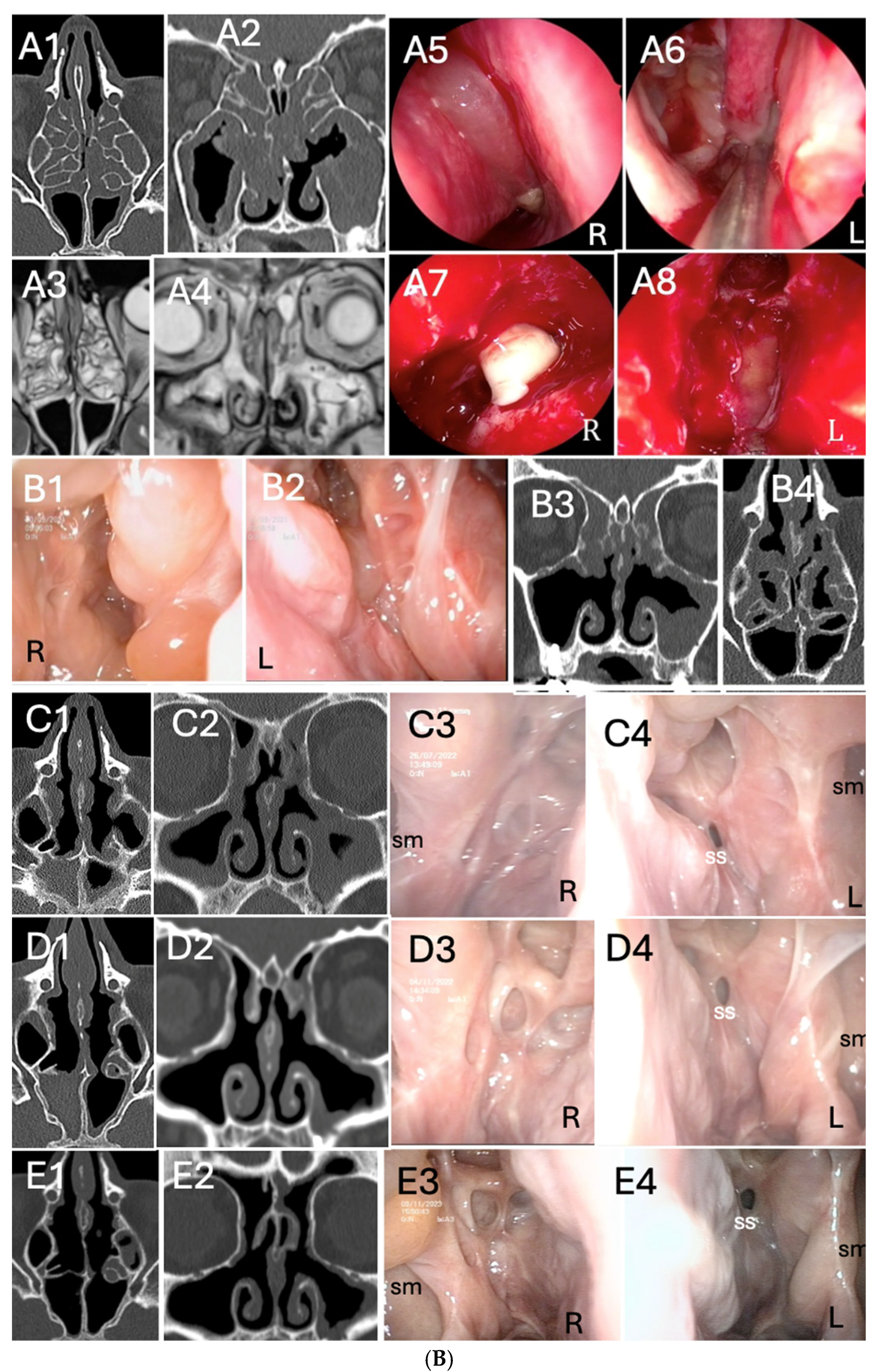 Biomedicines 13 00501 g003b