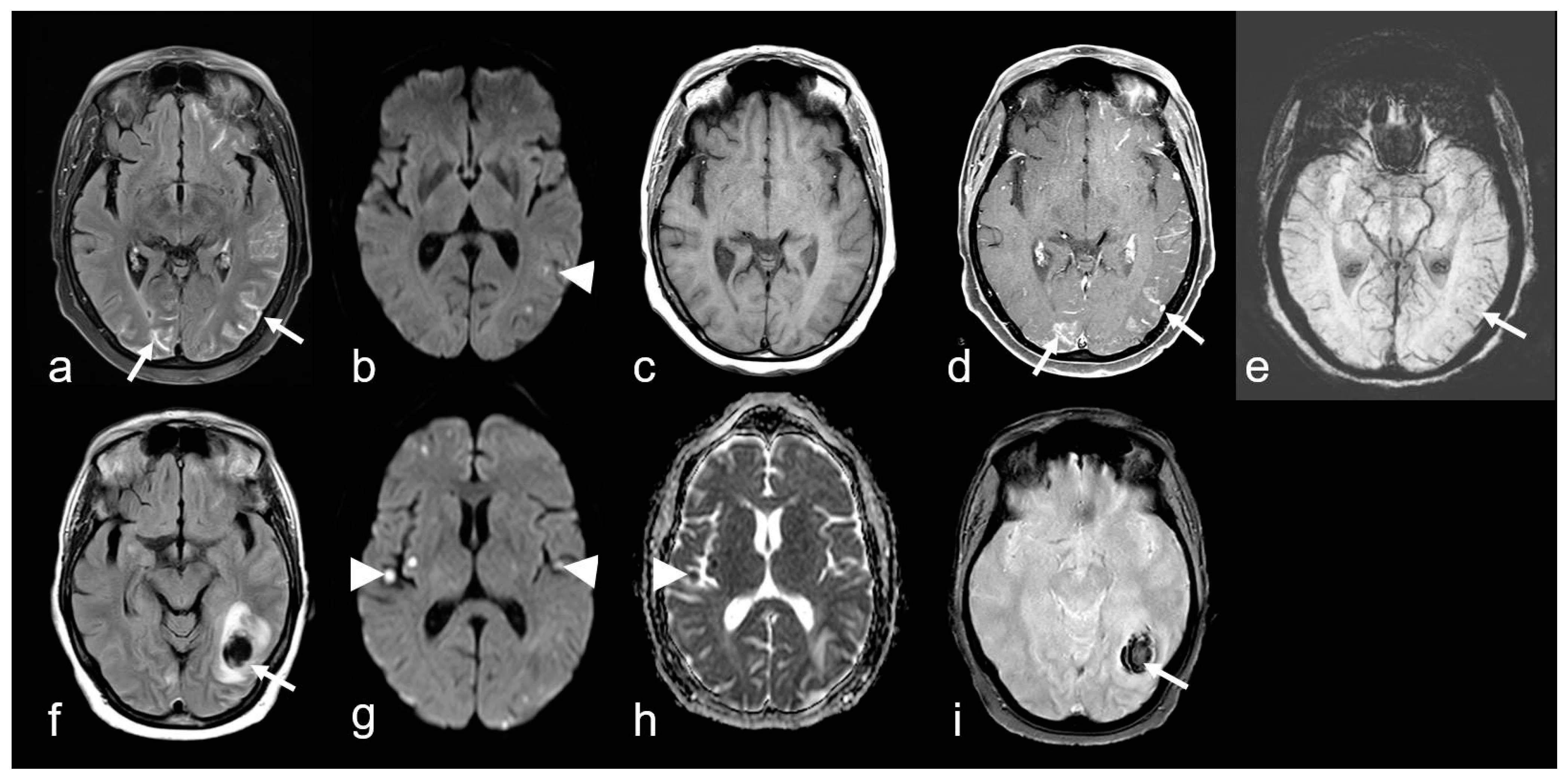 Biomedicines 13 00603 g007