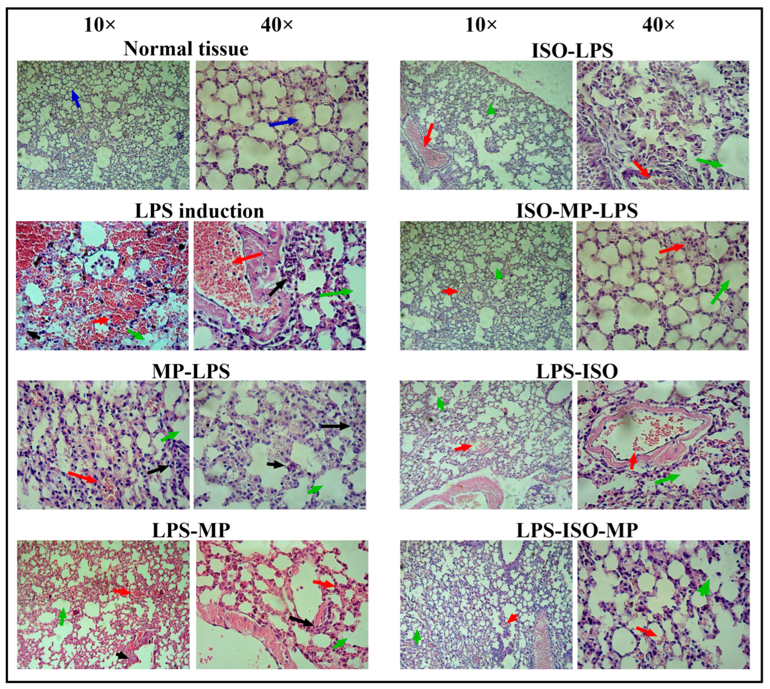 Biomedicines 13 00653 g004