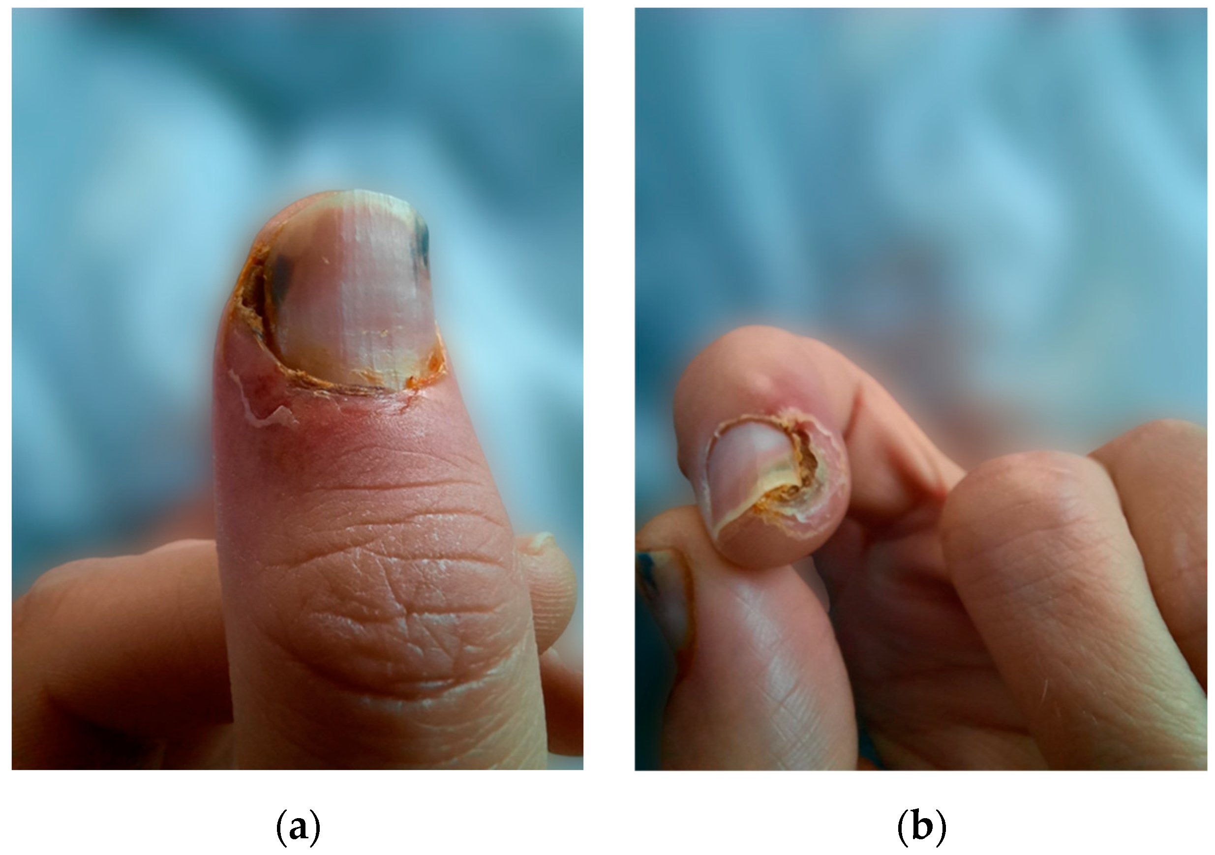 Biomedicines 13 00715 g001