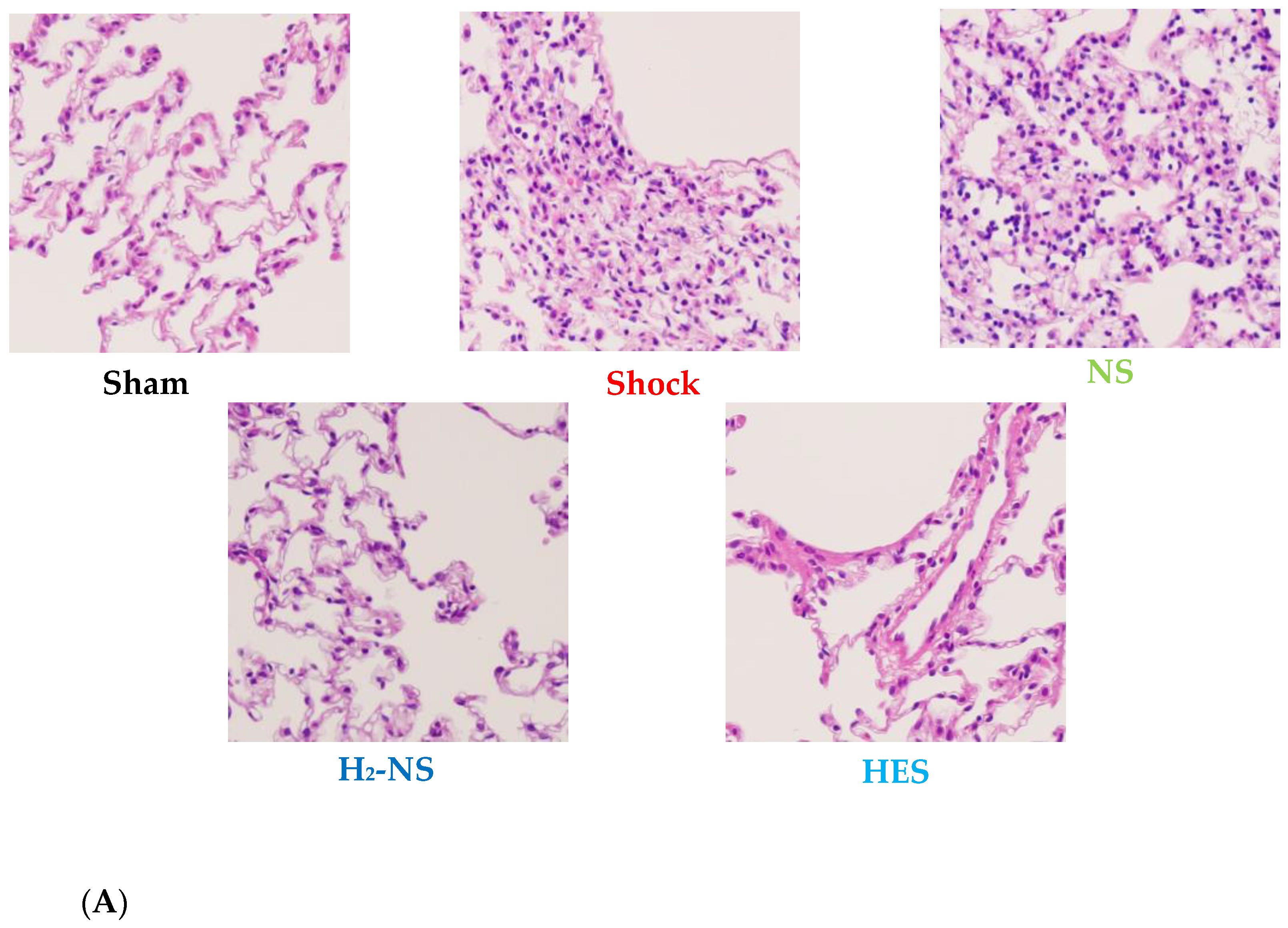 Biomedicines 13 00833 g006a