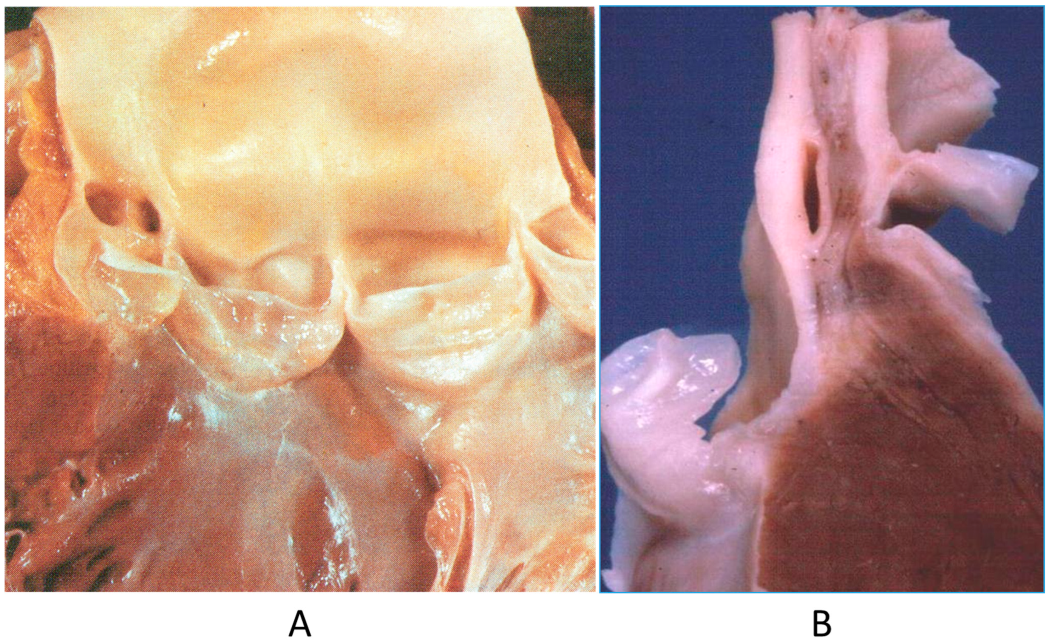 Biomedicines 13 00875 g001 Biomedicines 13 00875 g001