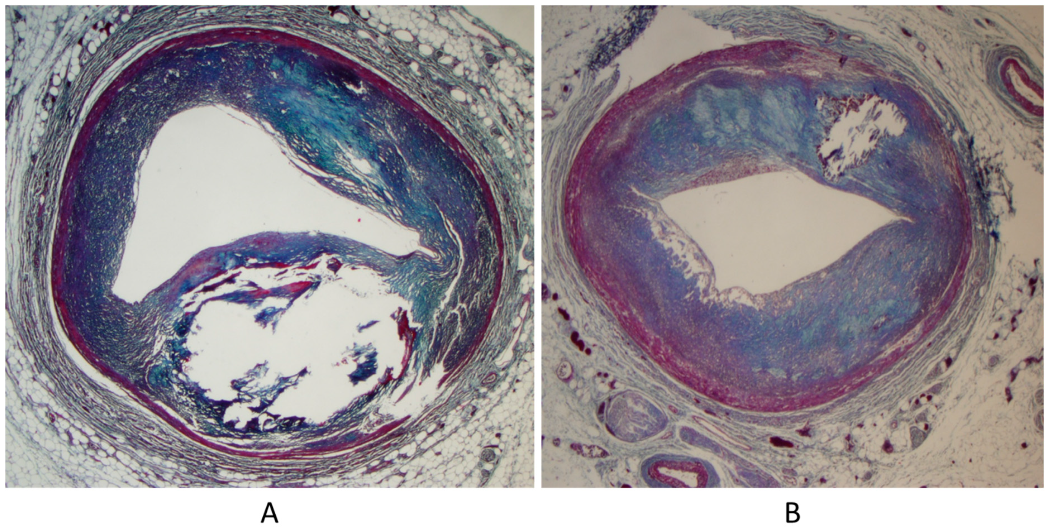 Biomedicines 13 00875 g006 Biomedicines 13 00875 g006
