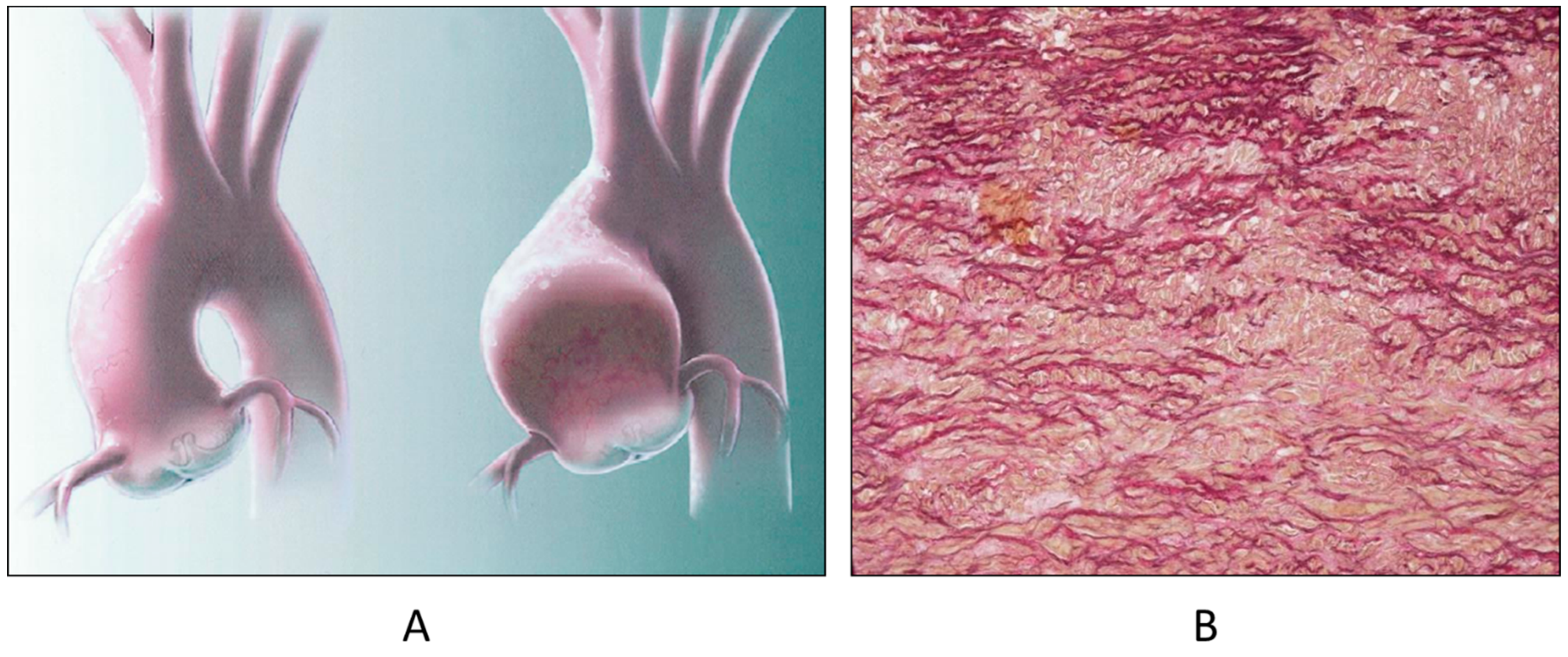 Biomedicines 13 00875 g008 Biomedicines 13 00875 g008