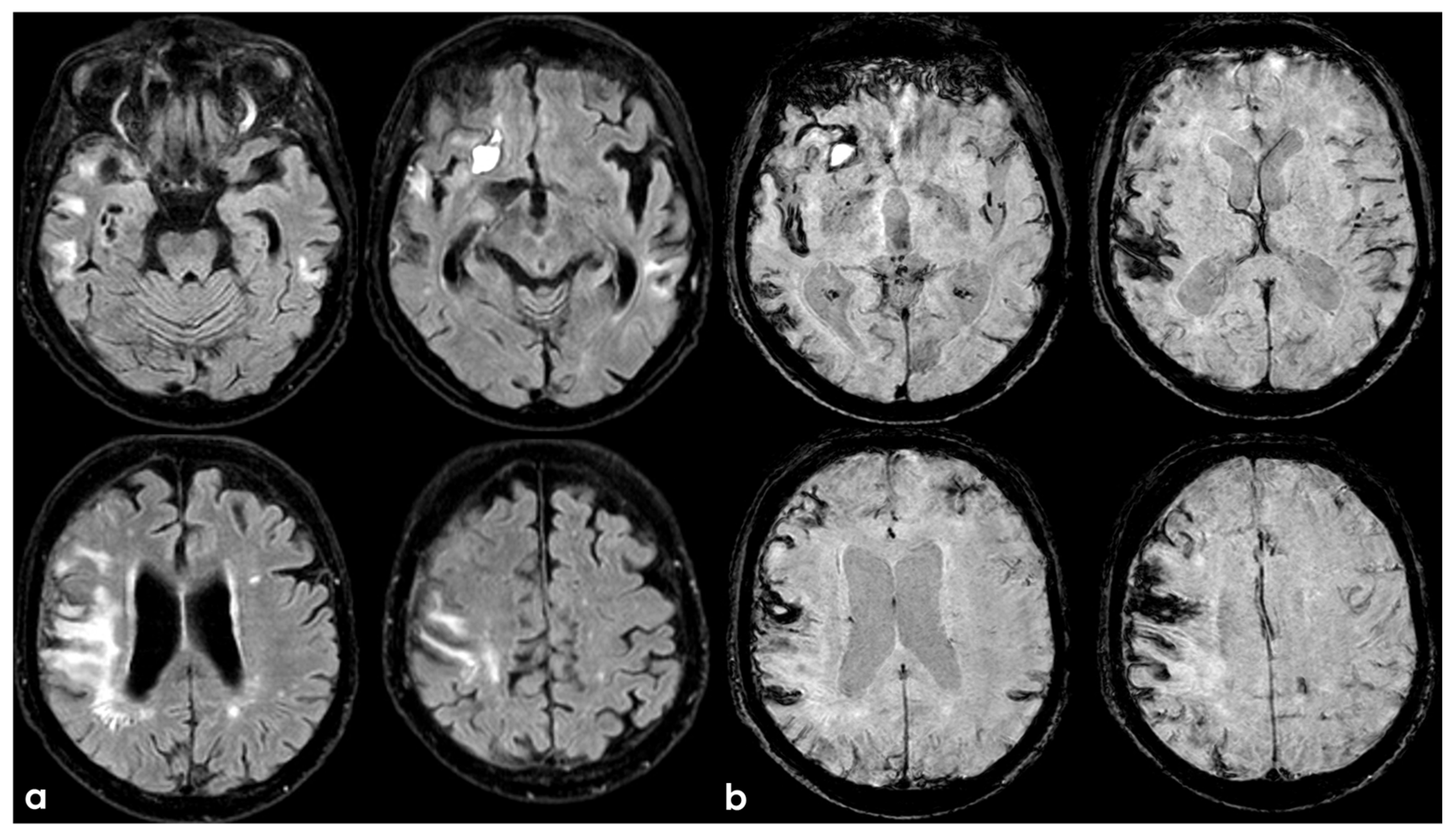 Biomedicines 13 00881 g004