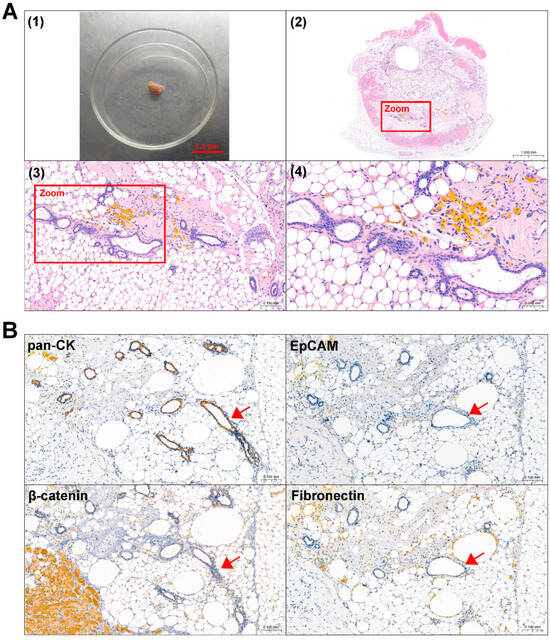 Biomedicines 13 00912 g005