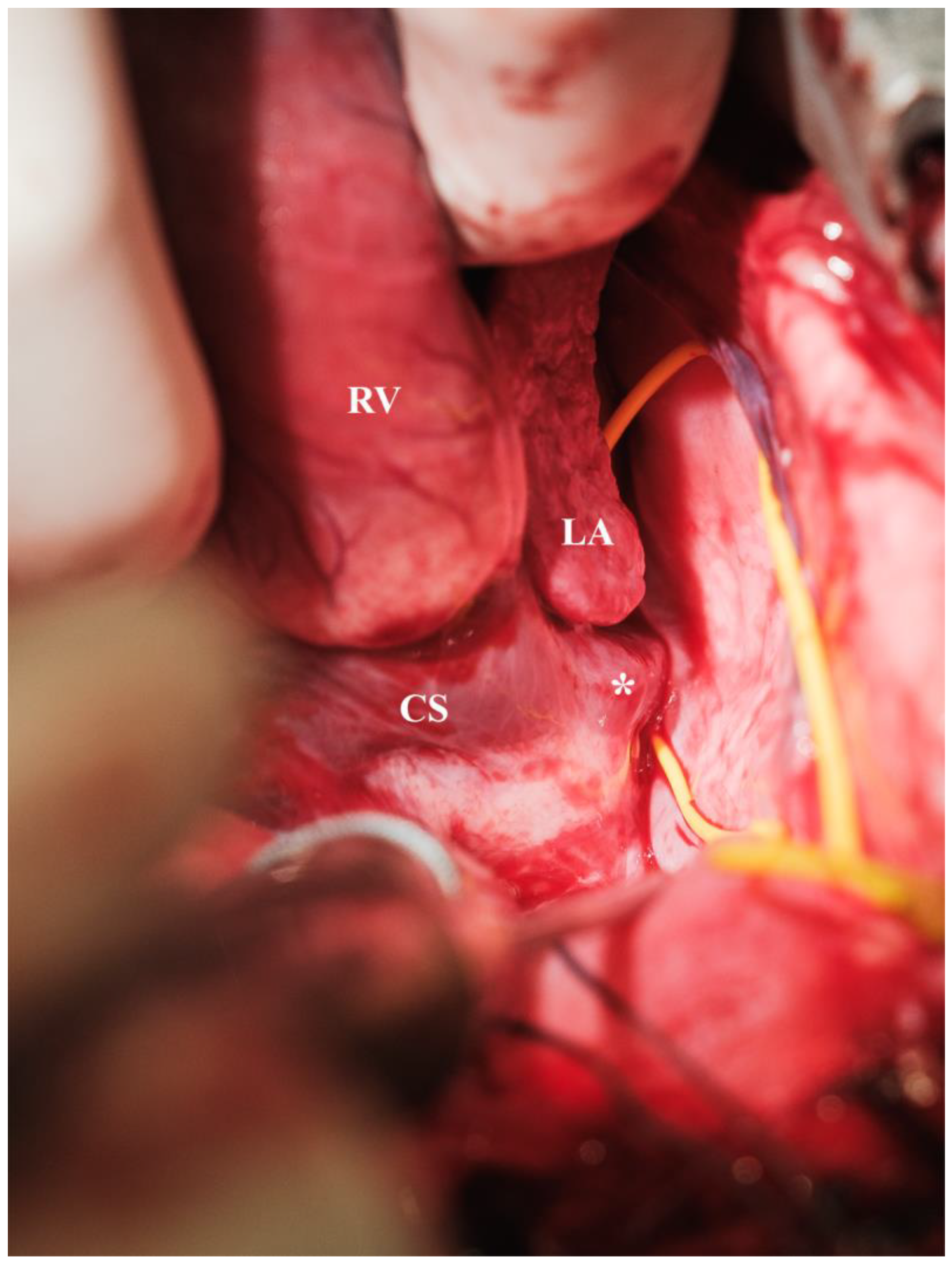 Biomedicines 13 00918 g005
