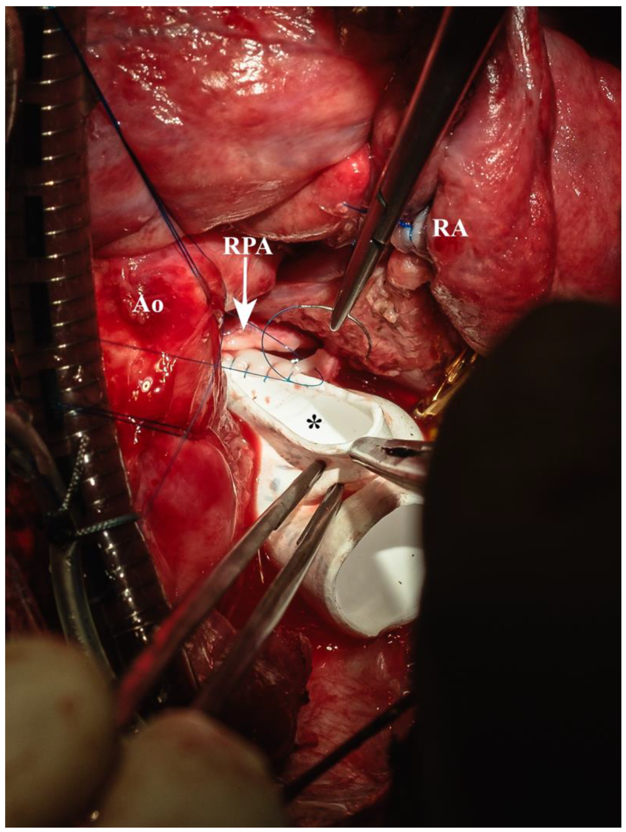 Biomedicines 13 00918 g008