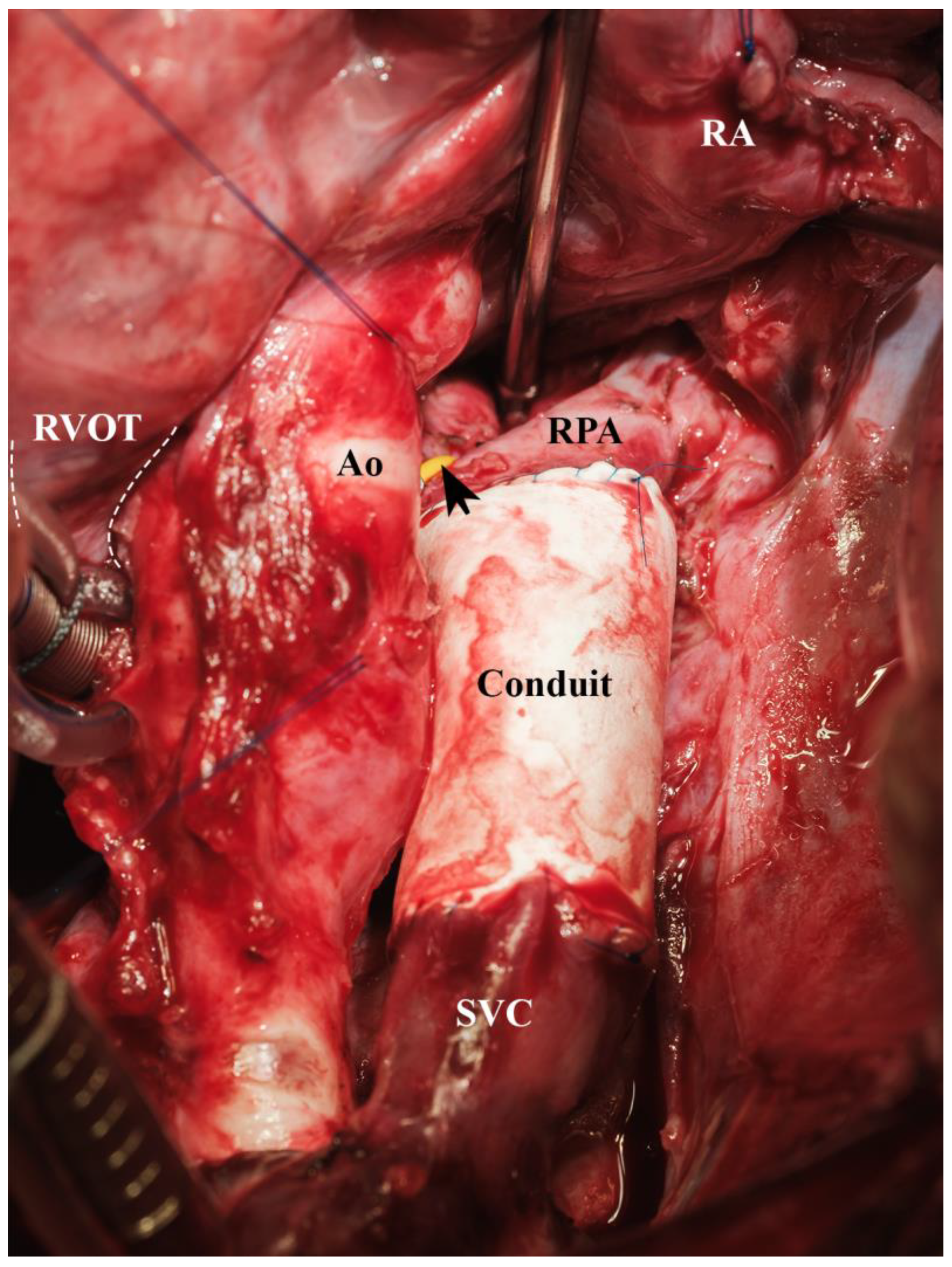 Biomedicines 13 00918 g012