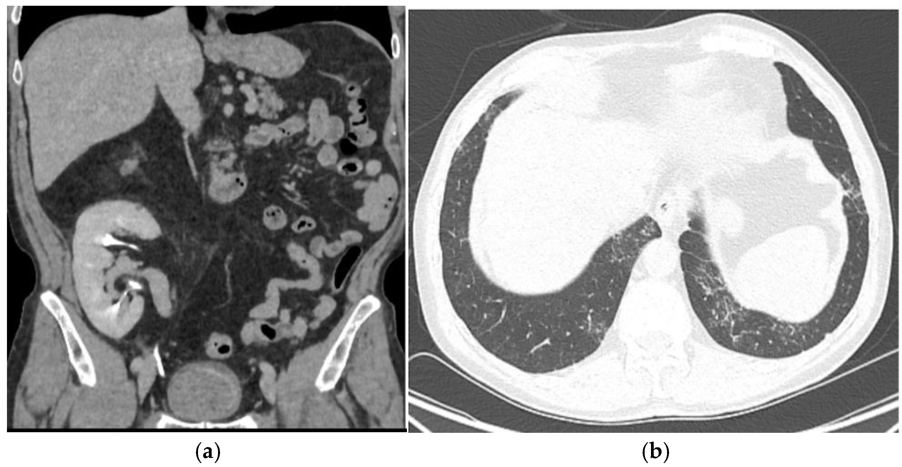 Biomedicines 13 01118 g001
