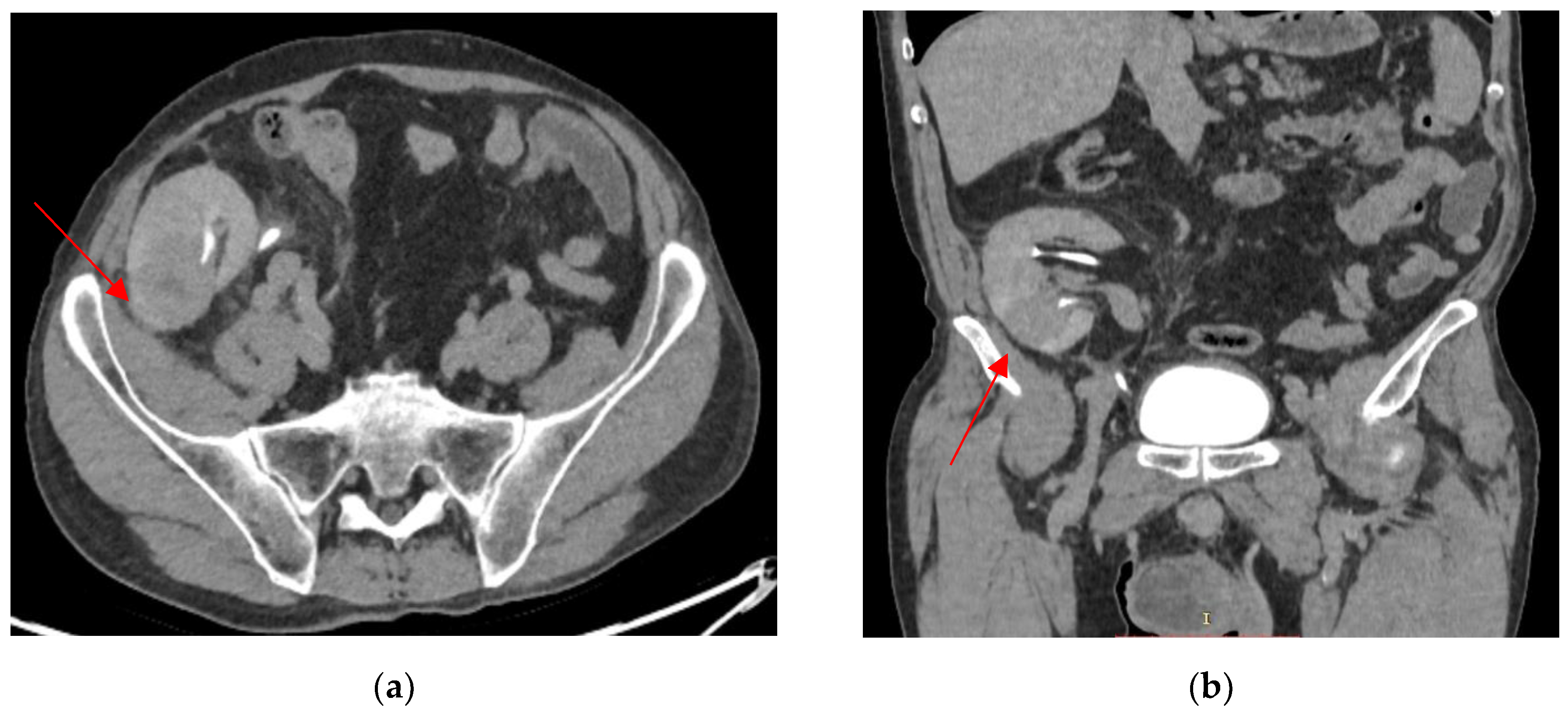 Biomedicines 13 01118 g003