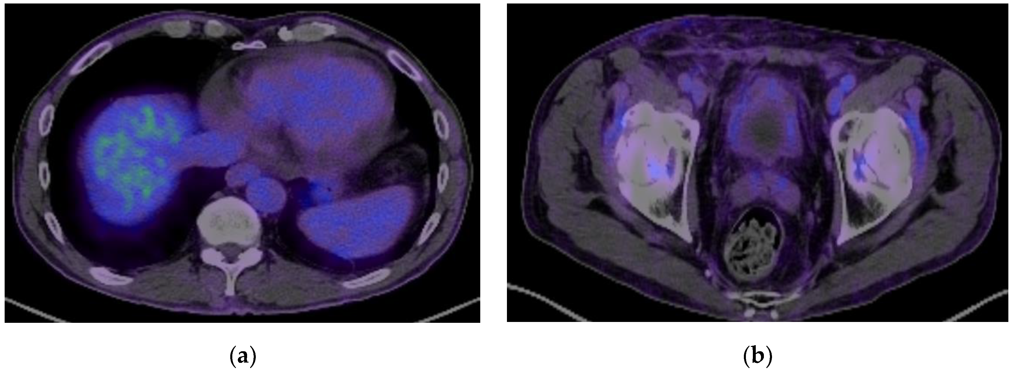 Biomedicines 13 01118 g005