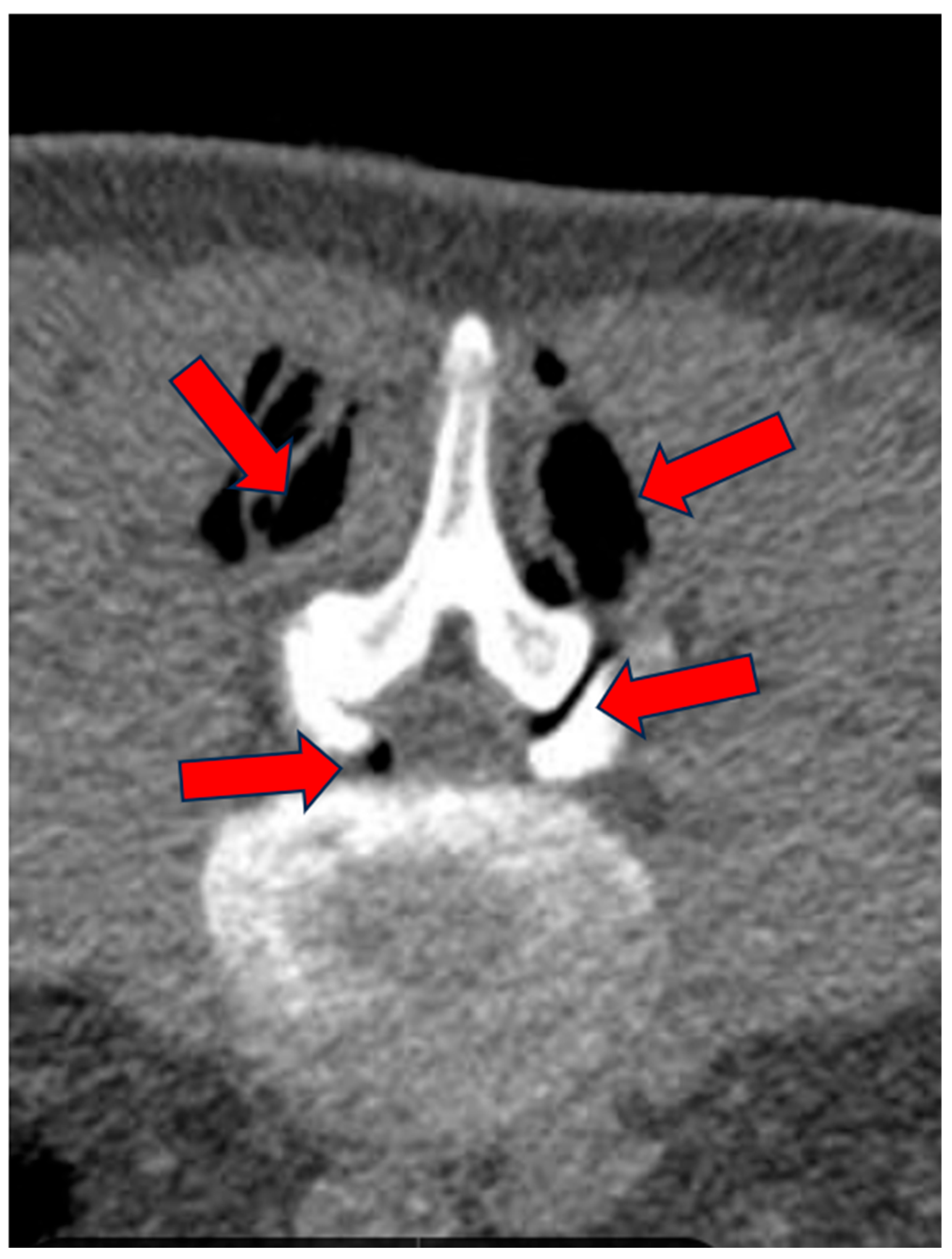 Biomedicines 13 01250 g005