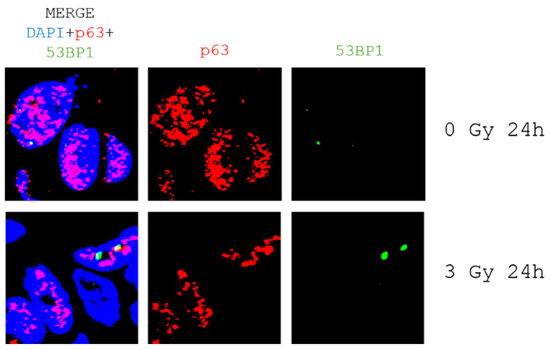 Biomedicines 13 01266 g0a4