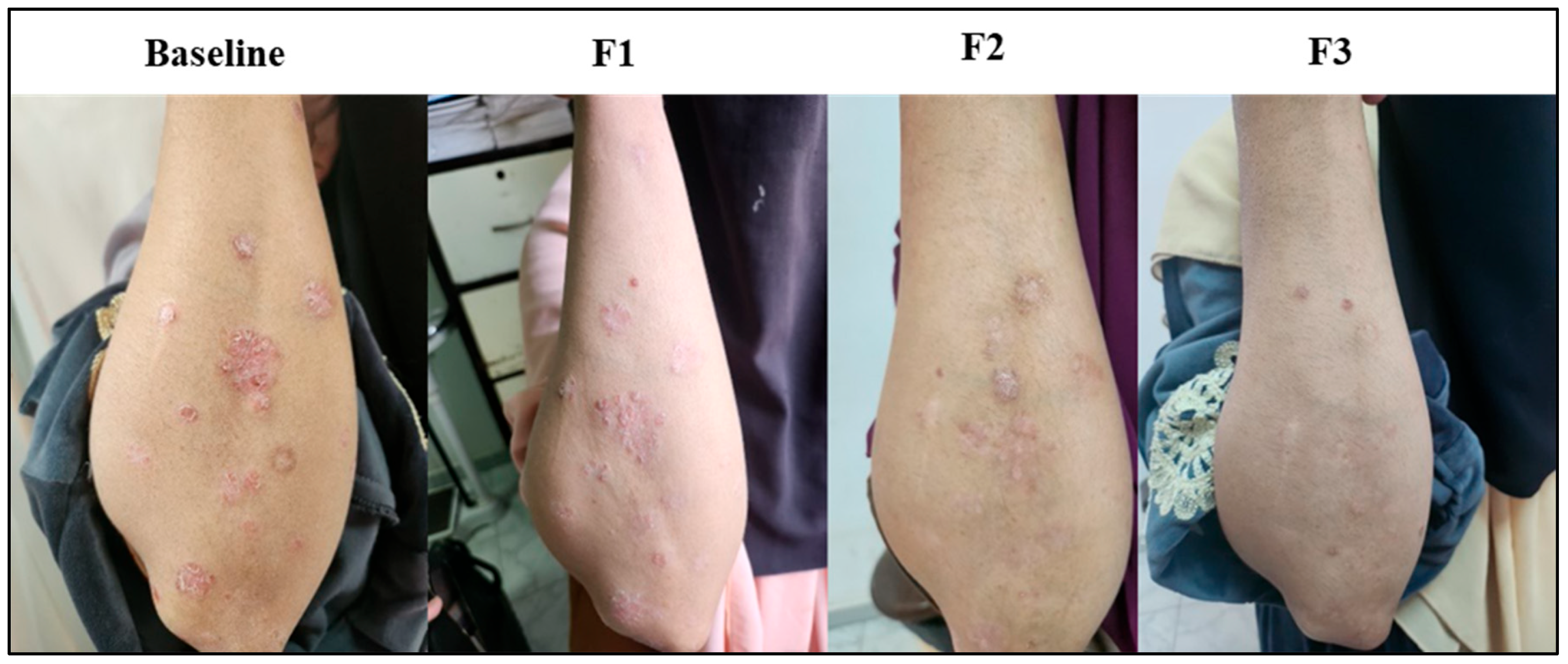 Biomedicines 13 01275 g006