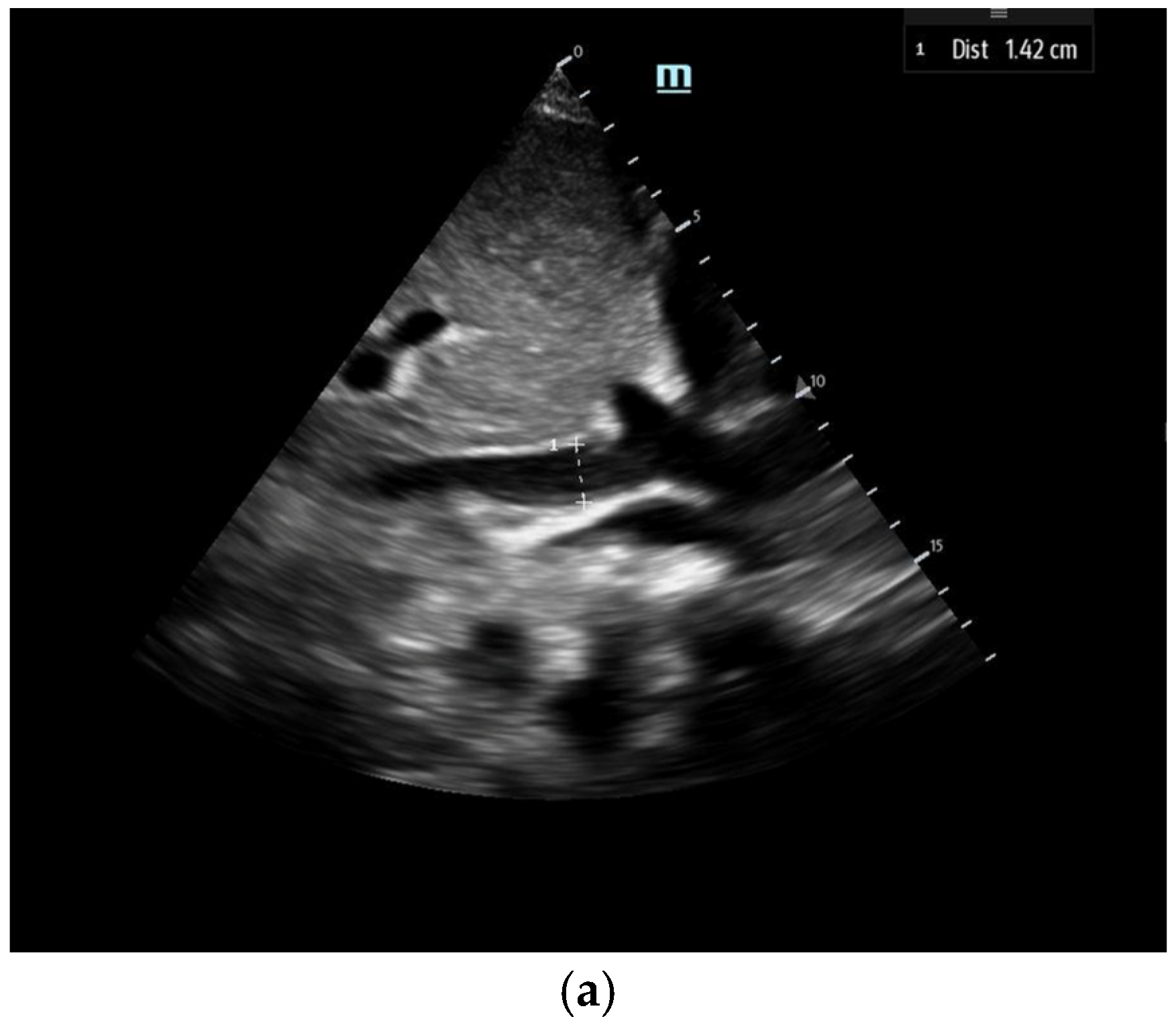 Biomedicines 13 01426 g002a