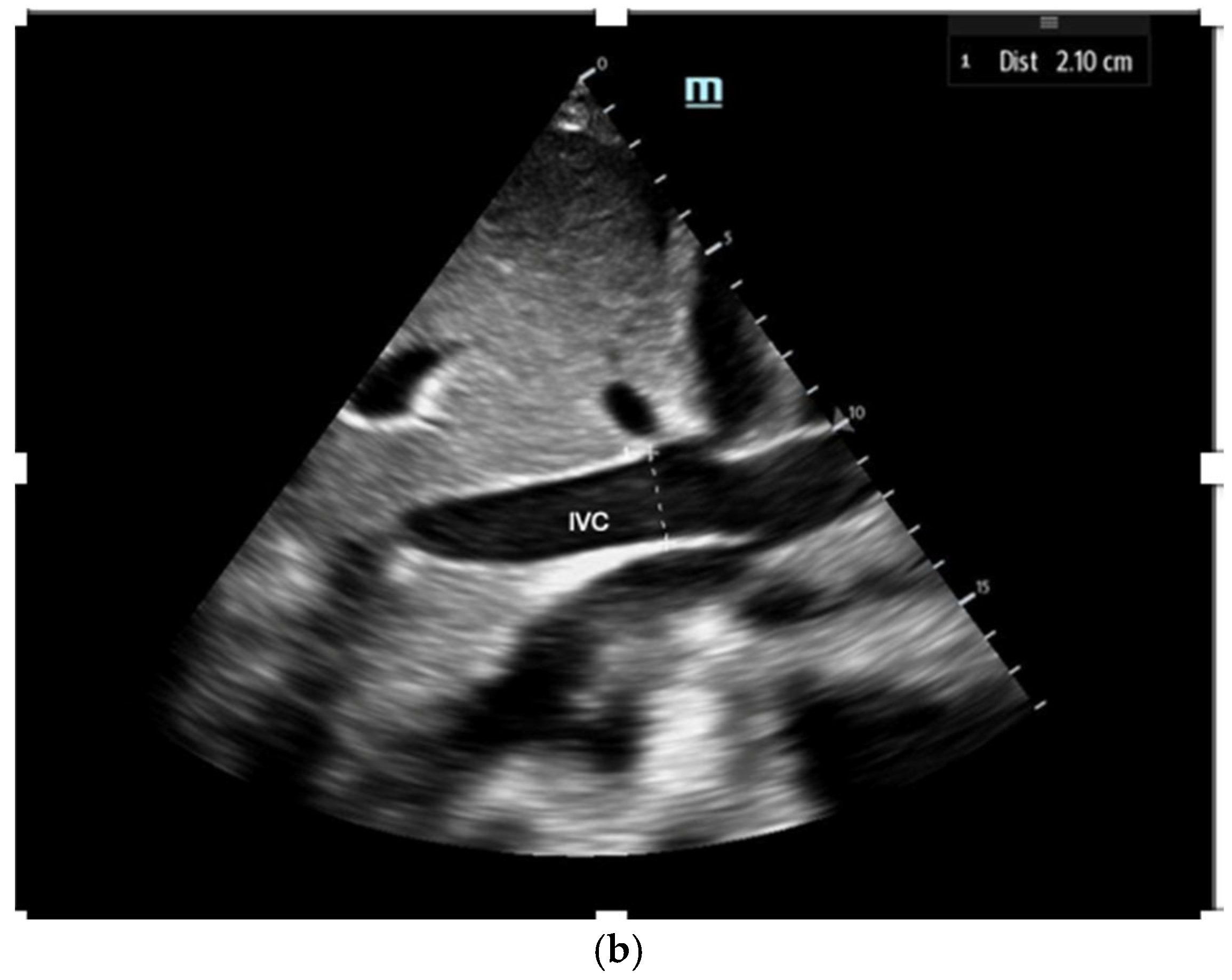 Biomedicines 13 01426 g002b