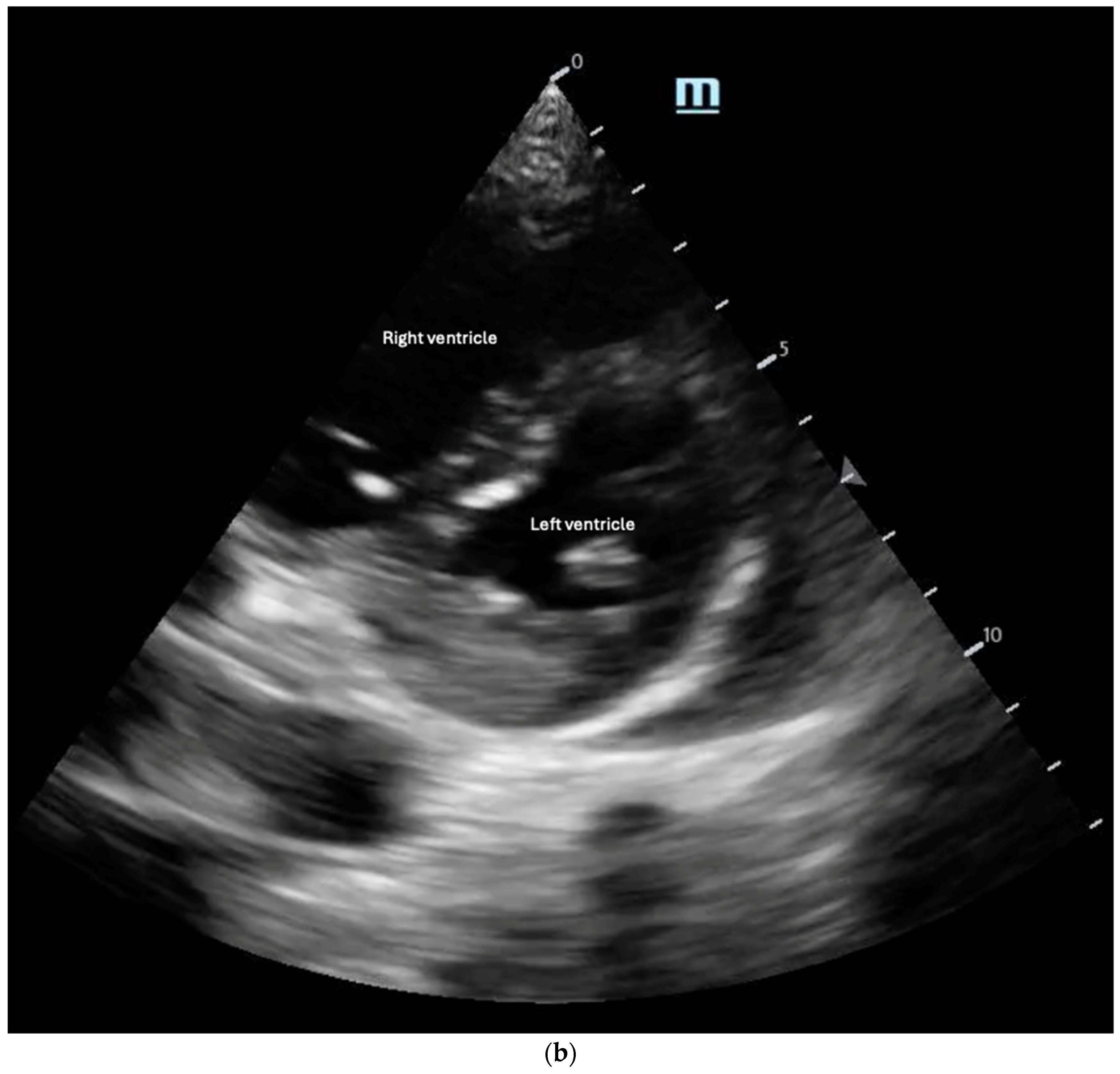 Biomedicines 13 01426 g008b