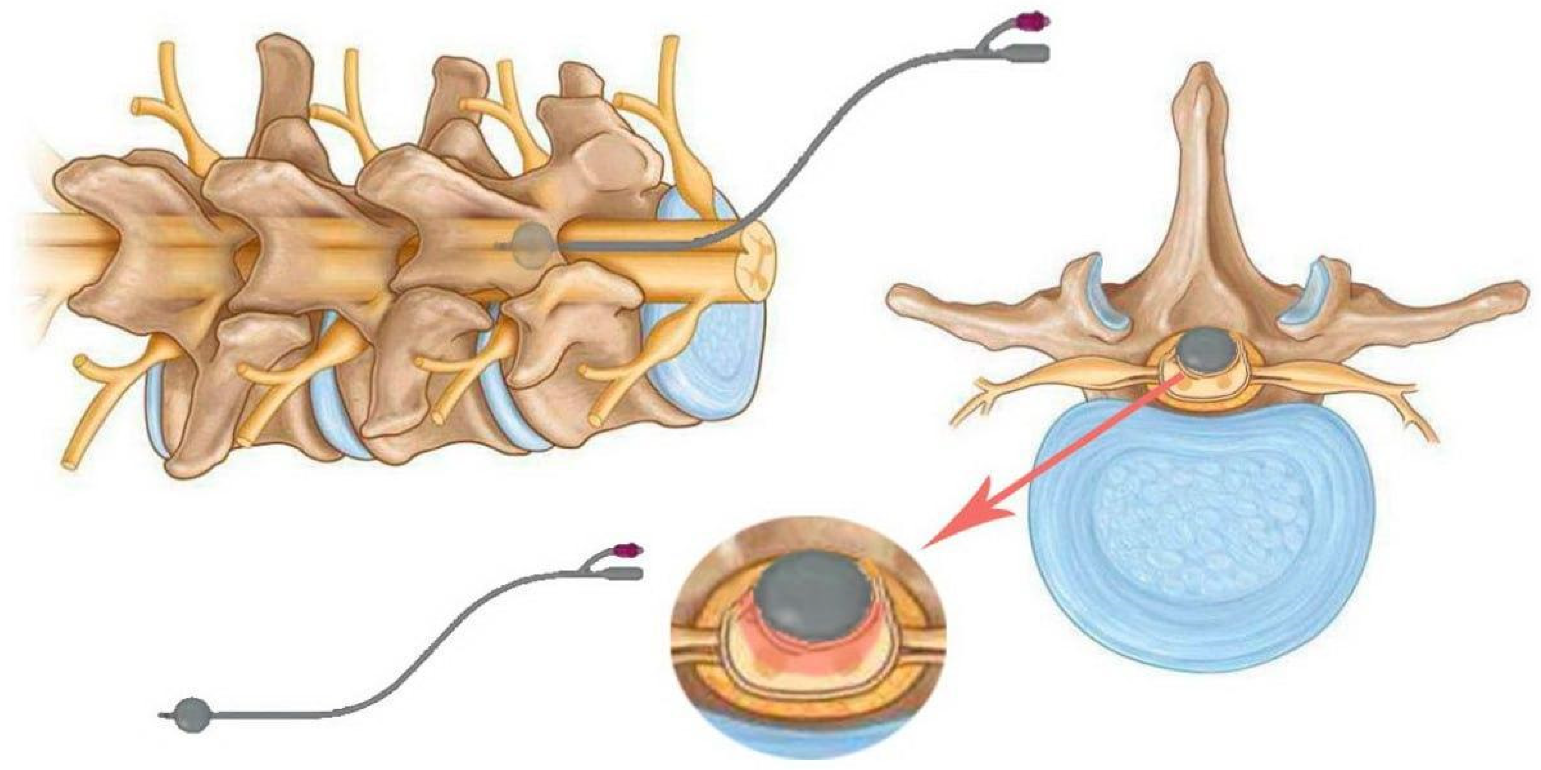 Biomedicines 13 01427 g005 Biomedicines 13 01427 g005