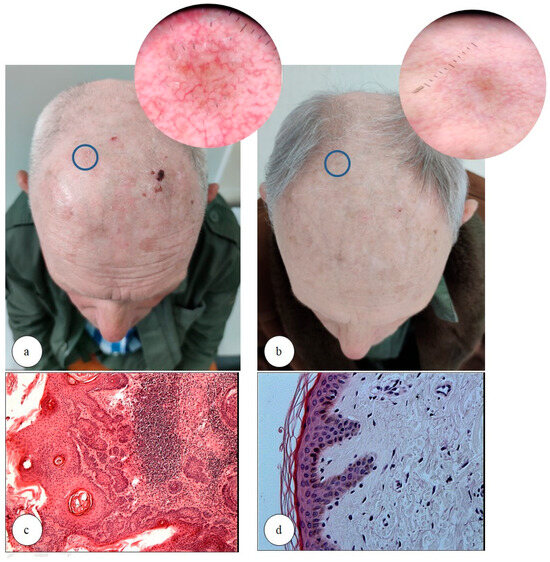 Biomedicines 13 01487 g001