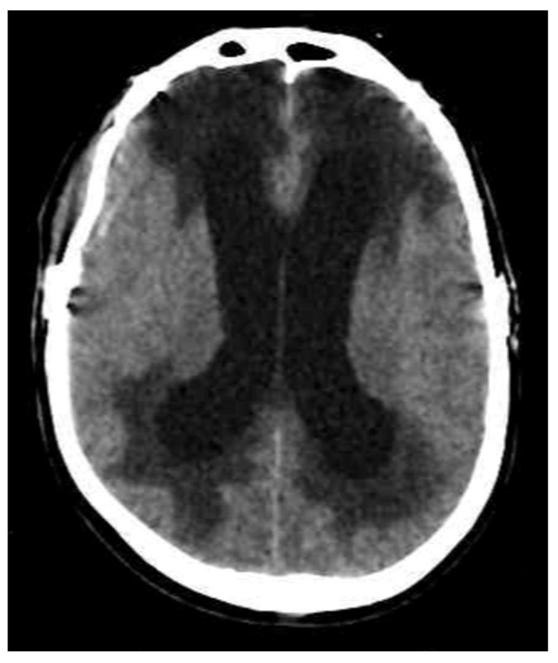 Biomedicines 13 01728 g004 Biomedicines 13 01728 g004