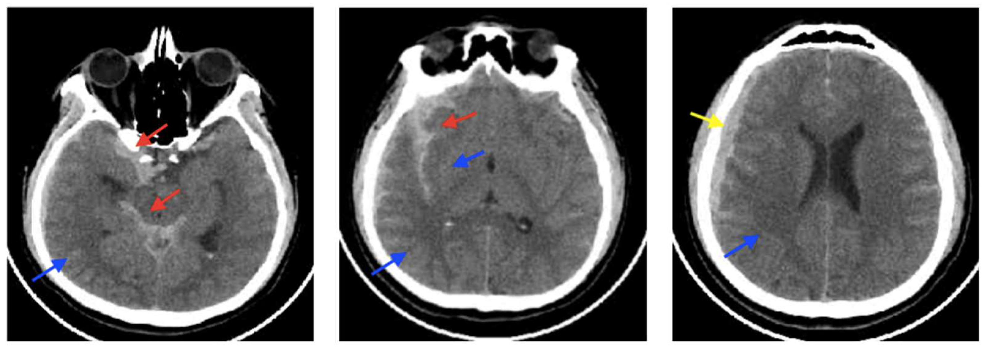 Biomedicines 13 01728 g007 Biomedicines 13 01728 g007