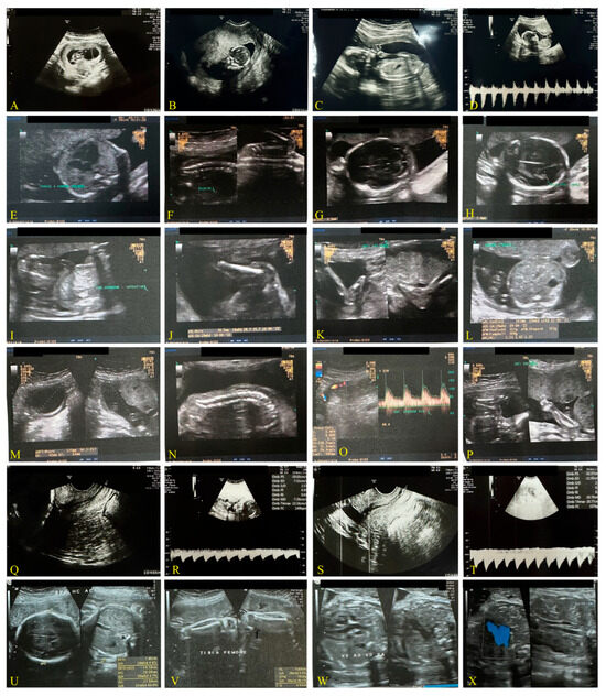 Biomedicines 13 01858 g003