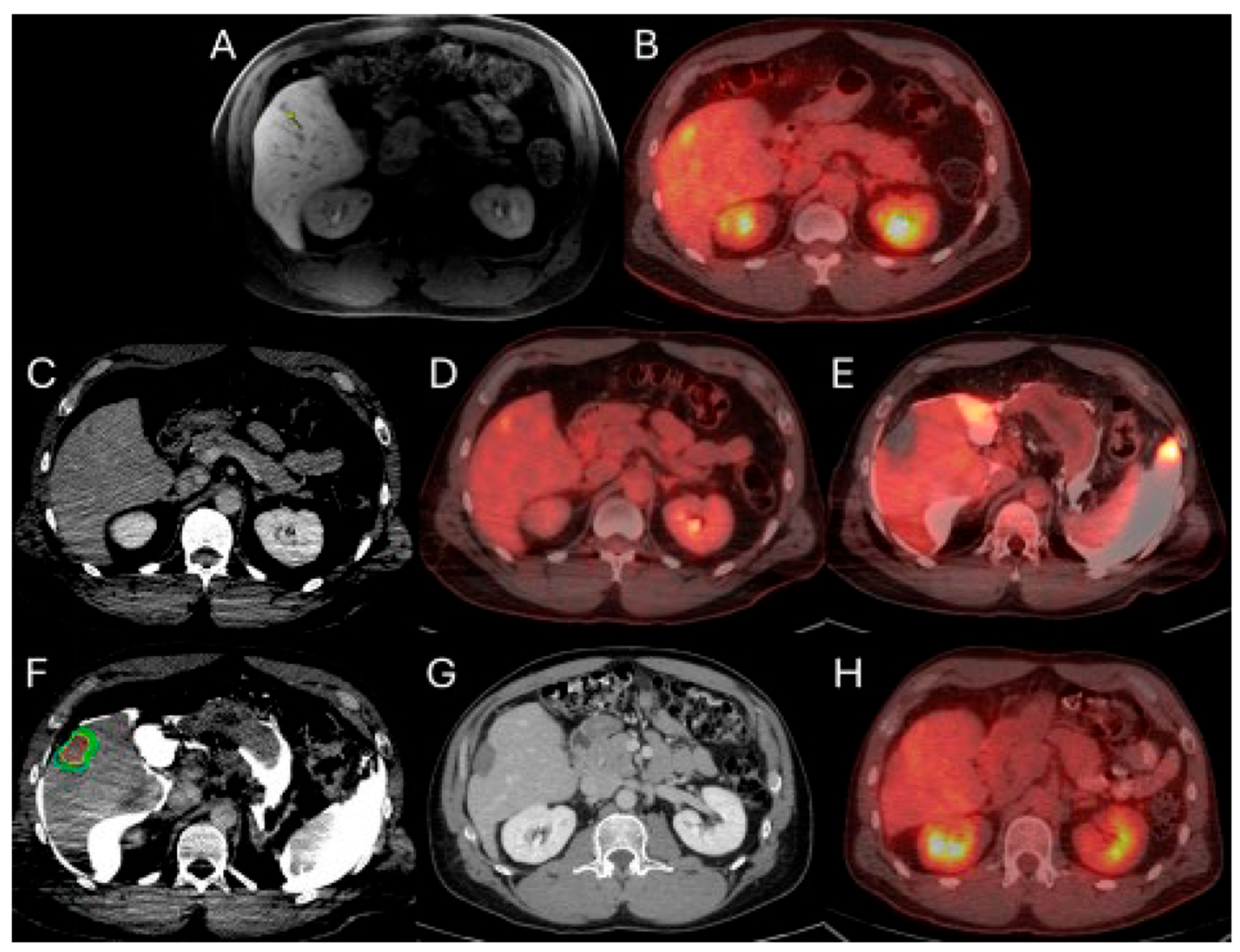 Biomedicines 13 02182 g001