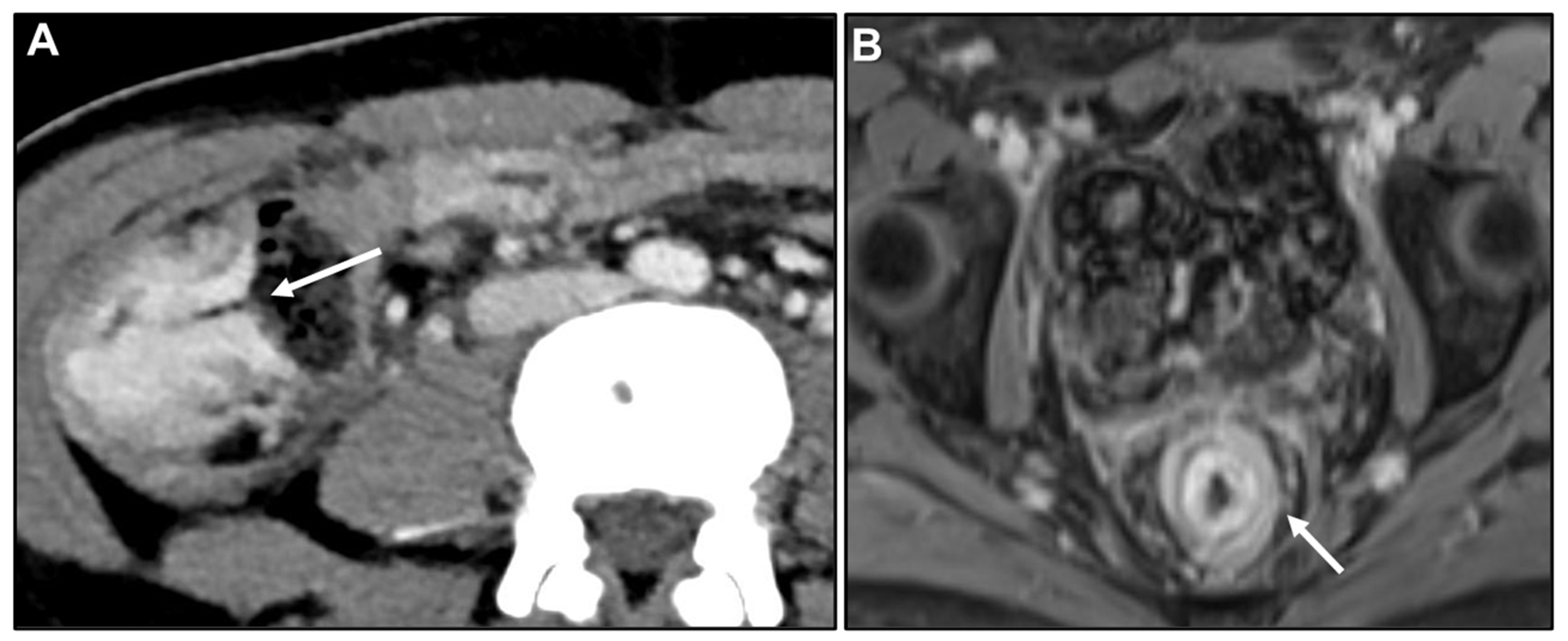 Biomedicines 13 02197 g005