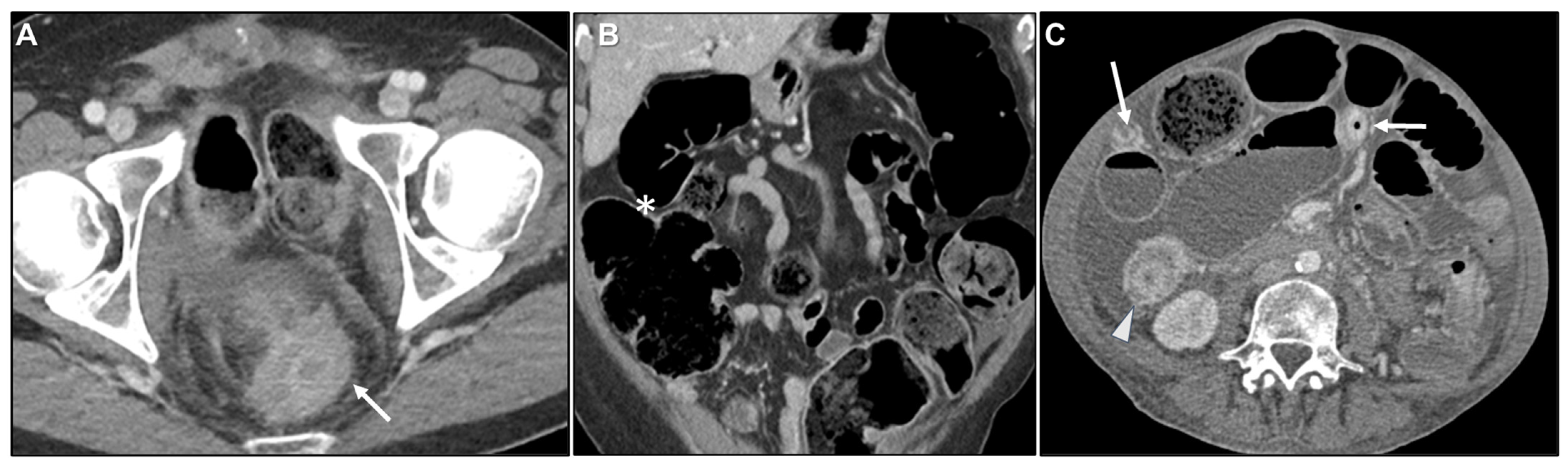 Biomedicines 13 02197 g013