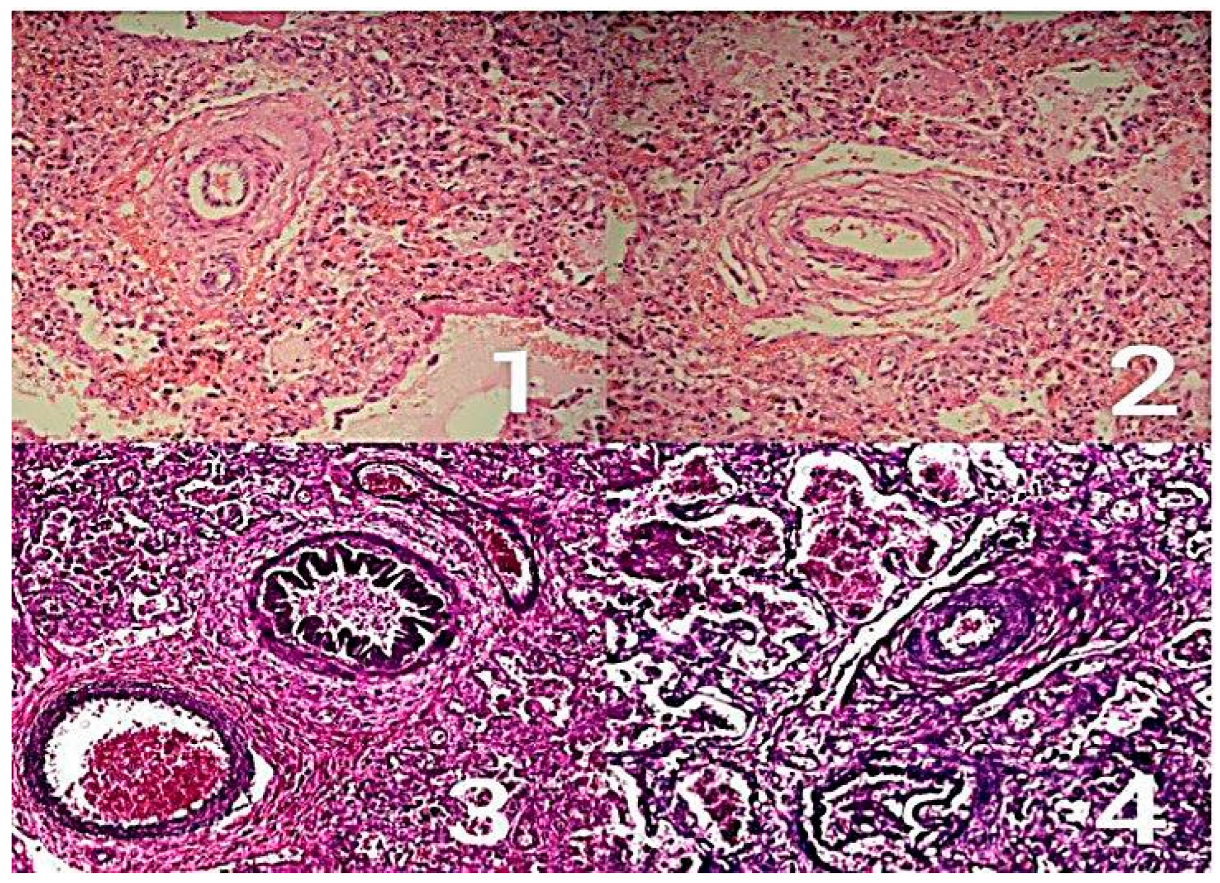 Biomedicines 13 02324 g001 Biomedicines 13 02324 g001