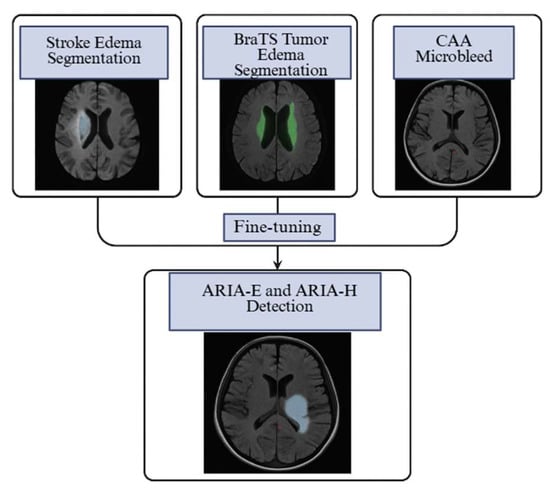 From Lesion to Decision: AI for ARIA Detection and Predictive Imaging ...