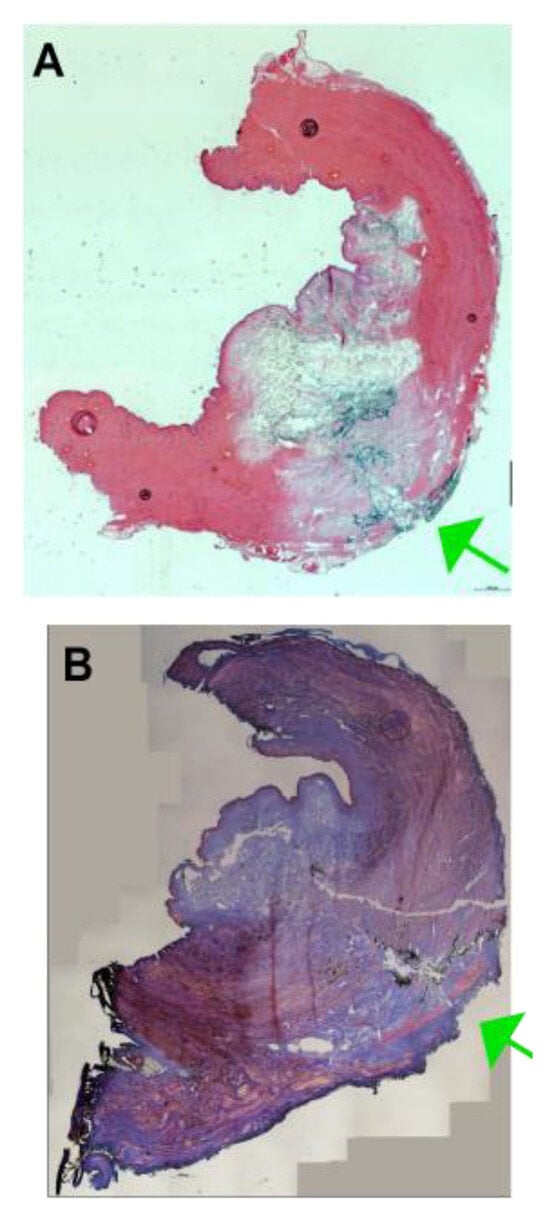 Biomedicines 13 02986 g0a4